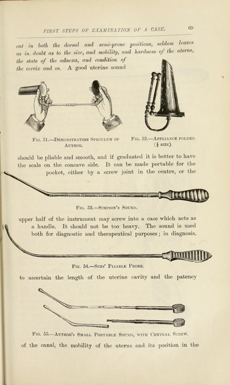 out in both the dorsal and semi-prone ^positions, seldom leaves us in. doubt as to the size, and mobility, and hardness of the uterus, the state of the adnexa, and condition of the cervix and os. A good uterine sound Fig. 51.—Demonstration J>rECULU3i of Author. Fig. 52,—Appliance folded (J size). should be pliable and smooth, and if graduated it is better to have the scale on the concave side. It can be made portable for the pocket, either by a screw joint in the centre, or the Fig. 53.—Simpson’s Sound. upper half of the instrument may screw into a case which acts as a handle. It should not be too heavy. The sound is used both for diagnostic and therapeutical purposes; in diagnosis. Fig. 51.—Sims’ Pliable Probe. to ascertain the length of the uterine cavity and the patency Fig. 55.—Author’s Small Portable Sound, with Central Screw. of the canal, the mobility of the uterus and its position in the