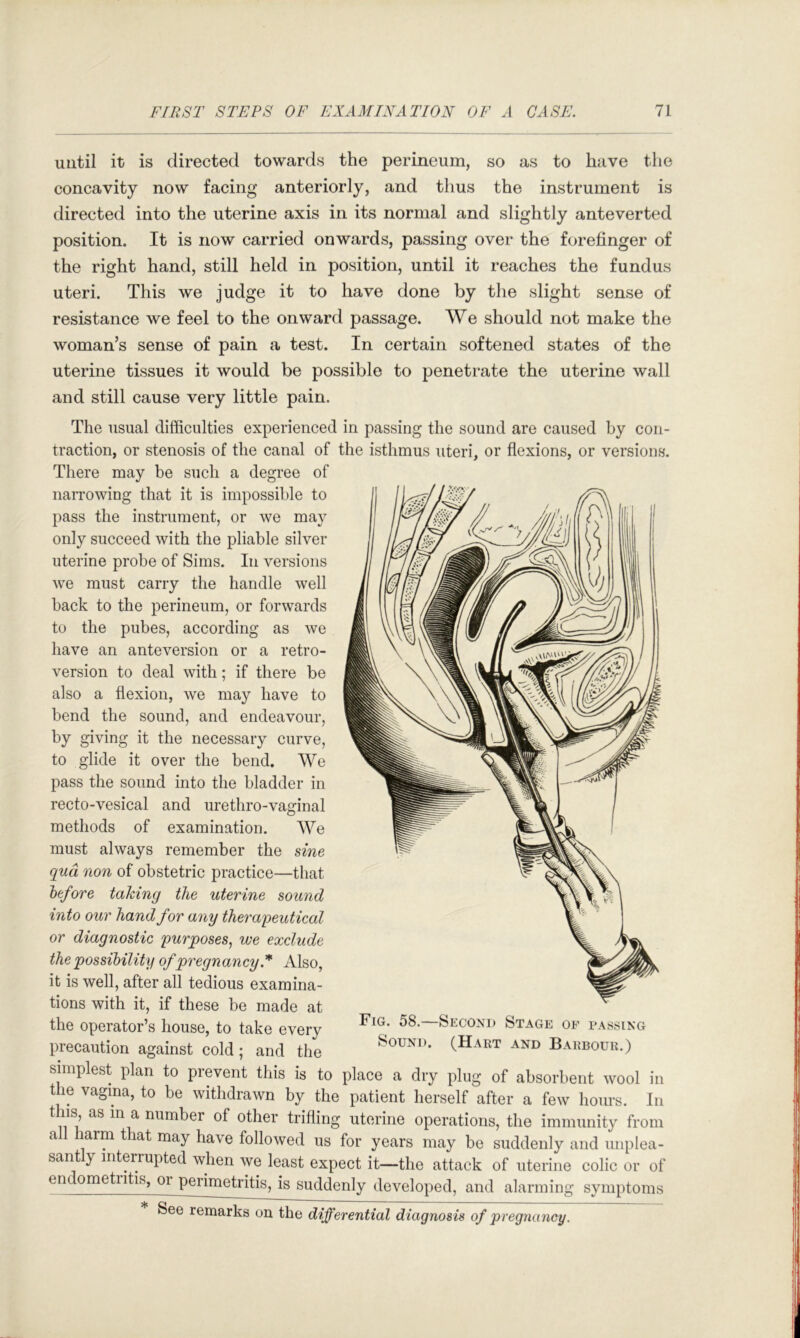 until it is directed towards the perineum, so as to have the concavity now facing anteriorly, and thus the instrument is directed into the uterine axis in its normal and slightly anteverted position. It is now carried onwards, passing over the forefinger of the right hand, still held in position, until it reaches the fundus uteri. This we judge it to have done by the slight sense of resistance we feel to the onward passage. We should not make the woman’s sense of pain a test. In certain softened states of the uterine tissues it would be possible to penetrate the uterine wall and still cause very little pain. The usual difficulties experienced in passing the sound are caused by con- traction, or stenosis of the canal of the isthmus uteri, or flexions, or versions. There may be such a degree of naiTOwing that it is impossible to pass the instrument, or we may only succeed with the pliable silver uterine probe of Sims. In versions we must carry the handle well back to the perineum, or forwards to the pubes, according as we have an anteversion or a retro- version to deal with; if there be also a flexion, we may have to bend the sound, and endeavour, by giving it the necessary curve, to glide it over the bend. We pass the sound into the bladder in recto-vesical and urethro-vaginal methods of examination. We must always remember the sine qua non of obstetric practice—that htfore taking the uterine sound into our hand for any therapeutical or diagnostic purposes^ we exclude the possibility of pregnancy Also, it is well, after all tedious examina- tions with it, if these be made at the operator’s house, to take every precaution against cold; and the simplest plan to prevent this is to place a dry plug of absorbent wool in the vagina, to be withdrawn by the patient herself after a few hours. In this, as m a number of other trifling uterine operations, the immunity from a larm that may have followed us for years may be suddenly and unplea- sant y interrupted when we least expect it—the attack of uterine colic or of en ometiitis, oi peiimetritis, is suddenly developed, and alarming symptoms See remarks on the differential diagnosis of pregnancy. Fig. 58.—Second Stage of passing
