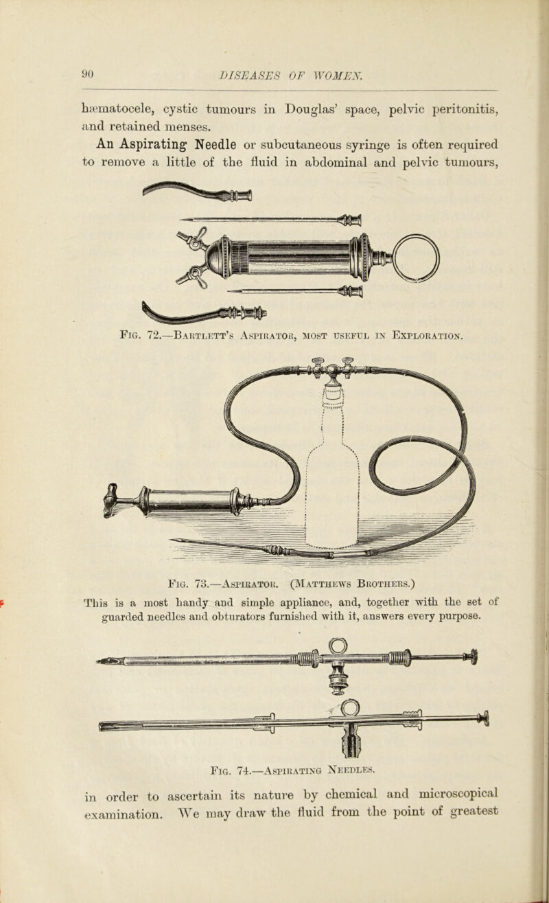 ha?matocele, cystic tumours in Douglas’ space, pelvic peritonitis, and retained menses. An Aspirating Needle or subcutaneous syringe is often required to remove a little of the fluid in abdominal and pelvic tumours. Fig. 72.—Bautlett’s AspinATOu, most useful in Exploration. Fig. 78.—Aspirator. (Matthews Brothers.) This is a most handy and simple appliance, and, together with the set of guarded needles and obturators furnished with it, answers every purpose. in order to ascertain its nature by chemical and microscopical examination. We may draw the fluid from the point of greatest