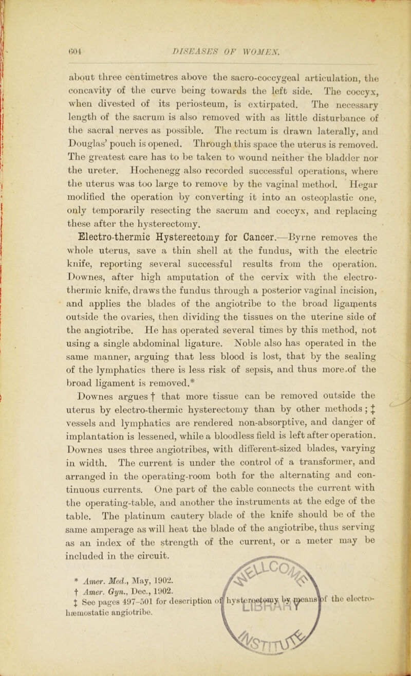 1 s (‘.04 DISEASIfJS OF W03IFN. about three centimetres above the sacro-coccygeal articulation, the • concavity of the curve being towards the left side. The coccyx, [ when divested of its periosteum, is extirpated. The necessary length of the sacrum is also removed with as little disturbance of the sacral nerves as possible. The rectum is drawn laterally, and I Douglas’ pouch is opened. Through this space the uterus is removed. ■ The greatest care has to be taken to wound neither the bladder nor ‘ the ureter. Hochenegg also recorded successful operations, where I) ' the uterus was too large to remove by the vaginal method. Hegar ' modified the operation by converting it into an osteoplastic one, j only temporarily resecting the sacrum and coccyx, and replacing these after the hysterectomy. Electro-thermic Hysterectomy for Cancer.—Byrne removes the whole uterus, save a thin shell at the fundus, with the electric knife, reporting several successful results from the operation. Downes, after high amputation of the cervix with the electro- I thermic knife, draws the fundus through a posterior vaginal incision, I ' and applies the blades of the angiotribe to the broad ligaipents I outside the ovaries, then dividing the tissues on the uterine side of I the angiotribe. He has operated several times by this method, not using a single abdominal ligature. Noble also has operated in the same manner, arguing that less blood is lost, that by the sealing of the lymphatics there is less risk of sepsis, and thus more,of the broad ligament is removed.* ) Downes argues | that more tissue can be removed outside the uterus by electro-thermic hysterectomy than by other methods ; ^ vessels and lymphatics are rendered non-absorptive, and danger of implantation is lessened, while a bloodless field is left after operation. Downes uses three angiotribes, with different-sized blades, varying in width. The current is under the control of a transformer, and arranged in the operating-room both for the alternating and con- tinuous currents. One part of the cable connects the current with the operating-table, and another the instruments at the edge of the table. The platinum cautery blade of the knife should be of the same amperage as will heat the blade of the angiotribe, thus serving as an index of the strength of the current, or a meter may be included in the circuit. * Amer. Med., May, 1902. t Amer. Gyn., Dec., 1902. X See })ages 497-501 for description o haemostatic angiotribe. i I ■V.L