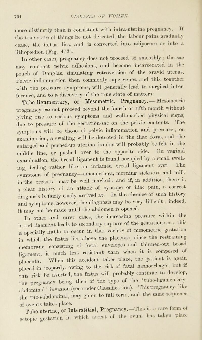 more distinctly than is consistent with intra-uterine pregnancy. If the true state of things be not detected, the labour pains gradually cease, the foetus dies, and is converted into adipocere or into a lithopsedion (Fig. 473). In other cases, pregnancy does not proceed so smoothly ; the sac may contract pelvic adhesions, and become incarcerated in the pouch of Douglas, simulating retroversion of the gravid uterus. Pelvic inflammation then commonly supervenes, and this, together with the pressure symptoms, will generally lead to surgical inter- ference, and to a discovery of the true state of matters. Tubo-ligamentary, or Mesometric, Pregnancy. — Mesometric pregnancy cannot proceed beyond the fourth or fifth month without giving rise to serious symptoms and well-marked physical signs, due to pressure of the gestation-sac on the pelvic contents. The symptoms will be those of pelvic inflammation and pressure; on examination, a swelling will be detected in the iliac fossa, and the enlarged and pushed-up uterine fundus will probably be felt in the middle line, or pushed over to the opposite side. On vaginal examination, the broad ligament is found occupied by a small swell- ing, feeling rather like an inflamed broad ligament cyst. The symptoms of pregnancy—amenorrhcea, morning sickness, and milk in die breasts—may be well marked; and if, in addition, there is a clear history of an attack of syncope or iliac pain, a correct diagnosis is fairly easily arrived at. In the absence of such history and symptoms, however, the diagnosis may be very difficult; indeed, it may not be made until the abdomen is opened. In other and rarer cases, the increasing pressure within the broad ligament leads to secondary rupture of the gestation-sac ; this is specially liable to occur in that variety of mesometric gestation in which the foetus lies above the placenta, since the restraining membrane, consisting of foetal envelopes and thinned-out broad ligament, is much less resistant than when it is composed of placenta. When this accident takes place, the patient is again placed in jeopardy, owing to the risk of fatal haemorrhage; but if this risk be averted, the foetus will probably continue to develop, the pregnancy being then of the type of the ‘ tubo-ligamentary- abdominal ’ invasion (see under Classification). This pregnancy, like the tubo-abdominal, may go on to full term, and the same sequence of events takes place. Tubo-uterine, or Interstitial, Pregnancy. ectopic gestation in which arrest of the —This is a rare form of ovum has taken place