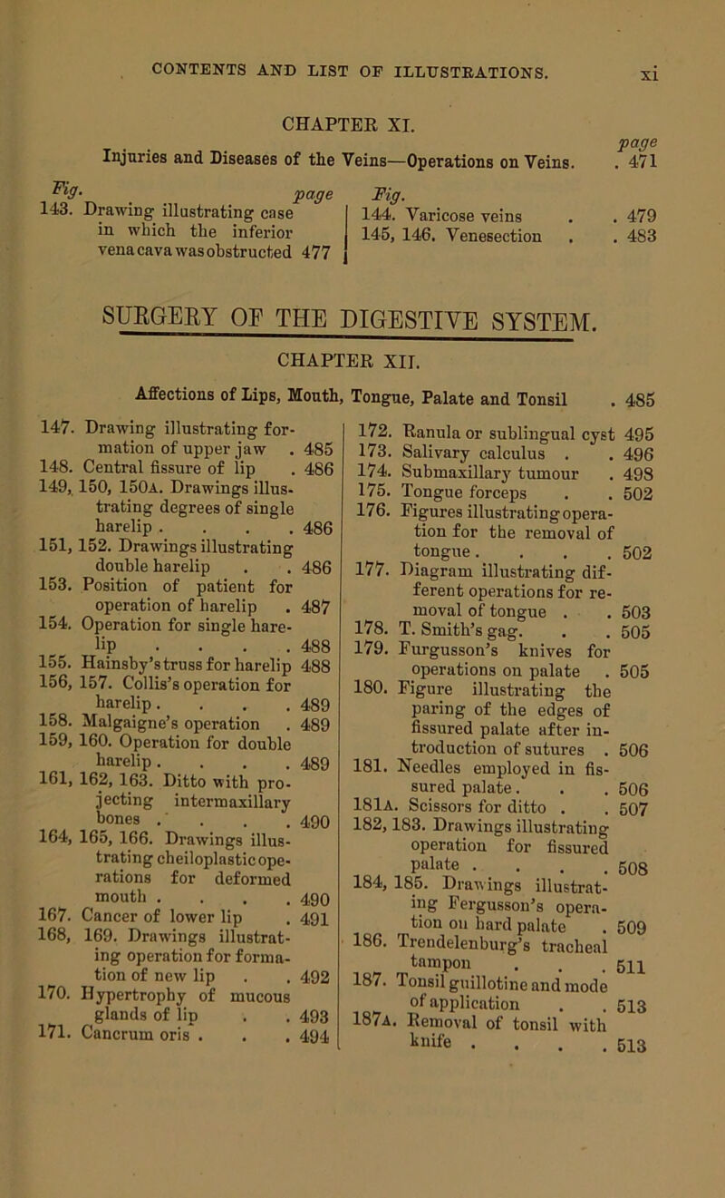 CHAPTER XI. Injuries and Diseases of the Veins—Operations on Veins. ^3- _ Mg, 143. Drawing illustrating case I 144. Varicose veins in which the inferior I 145, 146, Venesection vena cava was obstructed 477 | page . 471 . 479 . 483 SUBGEEY OF THE DIGESTIYE SYSTEM. CHAPTER XII. Affections of Lips, Mouth, 147. Drawing illustrating for- mation of upper jaw . 485 148. Central fissure of lip . 486 149. 150, 150a. Drawings illus- trating degrees of single harelip .... 486 151,152. Drawings illustrating double harelip . . 486 153. Position of patient for operation of harelip . 487 154. Operation for single hare- lip ... . 488 155. Hainsby’struss for harelip 488 156. 157. Collis’s operation for harelip. . . , 489 158. Malgaigne’s operation . 489 159,160. Operation for double harelip. . , .489 161, 162, 163. Ditto with pro- jecting intermaxillary bones , ' . . . 490 164, 165, 166. Drawings illus- trating cheiloplastic ope- rations for deformed mouth .... 490 167. Cancer of lower lip . 491 168, 169. Drawings illustrat- ing operation for forma- tion of new lip . . 492 170. Hypertrophy of mucous glands of lip . . 493 171. Cancrum oris . . . 494 Tongue, Palate and Tonsil . 485 172. Ranula or sublingual cyst 495 173. Salivary calculus . . 496 174. Submaxillary tumour . 498 175. Tongue forceps . . 502 176. Figures illustrating opera- tion for the removal of tongue.... 502 177. Diagram illustrating dif- ferent operations for re- moval of tongue . . 503 178. T. Smith’s gag. . . 505 179. Furgusson’s knives for operations on palate . 505 180. Figure illustrating the paring of the edges of fissured palate after in- troduction of sutures . 506 181. Needles employed in fis- sured palate. . . 506 181a. Scissors for ditto . , 507 182,183. Drawings illustrating operation for fissured palate . . . . 508 184, 185. Drawings illustrat- ing Fergusson’s opera- tion oil bard palate . 509 186. Trendelenburg’s tracheal tampon . . .511 187. Tonsil guillotine and mode ot application . . 513 187a. Removal of tonsil with l^nife . . . .513