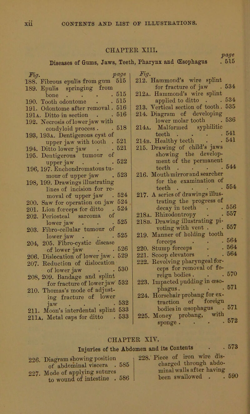 CHAPTER XIII. Diseases of Gums, Jaws, Teeth, Pharynx and (Esophagus page . 515 Fig. page 188. Fibrous epulis from gum 515 189. Epulis springing from bone .... 515 190. Tooth odontome . . 515 191. Odontome after removal. 516 191a. Ditto in section . . 516 192. Necrosis of lower jaw with condyloid process . . 518 193. 193a. Dentigerous cyst of upper jaw with tooth . 521 194. Ditto lower jaw . . 521 195. Dentigerous tumour of upper jaw . . . 522 196,197. Enchondromatous tu- mour of upper jaw . 523 198, 199. Drawings illustrating lines of incision for re- moval of upper jaw . 524 200. Saw for operation on jaw 524 201. Lion forceps for ditto . 524 202. Periosteal sarcoma of lower jaw . . . 525 203. Eibro-cellular tumour of lower jaw . . . 525 204. 205. Fibro-cystic disease of lower jaw . ■ 526 206. Dislocation of lower jaw . 529 207. Reduction of dislocation of lower jaw . . 530 208. 209. Bandage and splint for fracture of lower jaw 532 210. Thomas’s mode of adjust- ing fracture of lower jaw .... 532 211. Moon’s interdental splint 533 211a. Metal caps for ditto . 533 Fig. 212. Hammond’s wire splint for fracture of jaw 212a. Hammond’s wire splint applied to ditto . 213. Vertical section of tooth. 535 214. Diagram of developing lower molar tooth 214a. Malformed syphilitic teeth .... 214b. Healthy teeth 215. Drawing of child’s jaws showing the develop- ment of the permanent teeth .... 216. Mouth mirror and searcher for the examination of teeth . . •_ • A series of drawings illus- trating the progress of decay in teeth Rhizodontropy Drawing illustrating pi- voting with vent . Manner of holding tooth forceps Stump forceps Scoop elevators Revolving pharyngeal for- ceps for removal of fo- reign bodies. 223. Impacted pudding in oeso- phagus . . . • 224. Horsehair’ probang for ex- traction of foreign bodies in oesophagus 225. Money probang, with sponge . . . • 217. 218a. 218b. 219. 220. 221. 222. 534 534 536 541 541 544 554 556 557 557 564 564 564 570 571 571 572 CHAPTER XIV, Injuries of the Abdomen and its Contents 226. Diagram showing position of abdominal viscera . 585 227. Mode of applying sutures to wound of intestine . 586 228. Piece of iron wire dis- charged through abdo- minal walls after having been swallowed , , 590