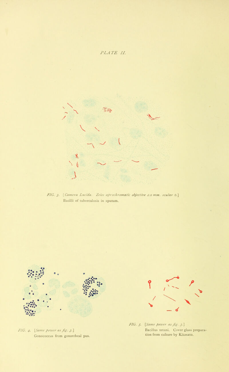 \ N V V FIG. 3. [Camera Lucida. Zeiss aprochromatic objective 2.0 mm. ocular 6.] Bacilli of tuberculosis in sputum. * sA • • * c • ***** T - ef X \ FIG. 4. [Same power as fig. 3.] Gonococcus from gonorrheal pus. FIG. 3. [Same power as fig. 3.] Bacillus tetani. Cover glass prepara- tion from culture by Kitasato.