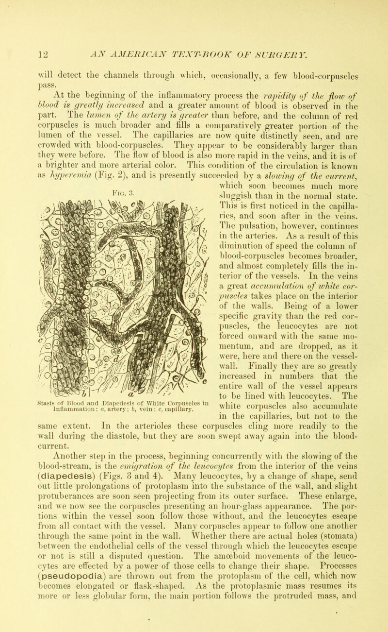 will detect the channels through which, occasionally, a few blood-corpuscles pass. At the beginning of the inflammatory process the rapidity of the flow of blood is greatly increased and a greater amount of blood is observed in the part. The lumen of the artery is greater than before, and the column of red corpuscles is much broader and fills a comparatively greater portion of the lumen of the vessel. The capillaries are now quite distinctly seen, and are crowded with blood-corpuscles. They appear to be considerably larger than they were before. The flow of blood is also more rapid in the veins, and it is of a brighter and more arterial color. This condition of the circulation is known as hyperemia (Fig. 2), and is presently succeeded by a slowing of the current, which soon becomes much more sluggish than in the normal state. This is first noticed in the capilla- ries, and soon after in the veins. The pulsation, however, continues in the arteries. As a result of this diminution of speed the column of blood-corpuscles becomes broader,, and almost completely fills the in- terior of the vessels. In the veins a great accumulation of white cor- puscles takes place on the interior of the walls. Being of a lower specific gravity than the red cor- puscles, the leucocytes are not forced onward with the same mo- mentum, and are dropped, as it were, here and there on the vessel- wall. Finally they are so greatly increased in numbers that the entire wall of the vessel appears to be lined with leucocytes. The white corpuscles also accumulate in the capillaries, but not to the same extent. In the arterioles these corpuscles cling more readily to the wall during the diastole, but they are soon swept away again into the blood- current. Another step in the process, beginning concurrently with the slowing of the blood-stream, is the emigration of the leucocytes from the interior of the veins (diapedesis) (Figs. 3 and 4). Many leucocytes, by a change of shape, send out little prolongations of protoplasm into the substance of the wall, and slight protuberances are soon seen projecting from its outer surface. These enlarge, and we now see the corpuscles presenting an hour-glass appearance. The por- tions within the vessel soon follow those without, and the leucocytes escape from all contact with the vessel. Many corpuscles appear to follow one another through the same point in the wall. Whether there are actual holes (stomata) between the endothelial cells of the vessel through which the leucocytes escape or not is still a disputed question. The amoeboid movements of the leuco- cytes are effected by a power of those cells to change their shape. Processes (pseudopodia) are thrown out from the protoplasm of the cell, which now becomes elongated or flask-shaped. As the protoplasmic mass resumes its more or less globular form, the main portion follows the protruded mass, and Fig. 3. Stasis of Blood and Diapedesis of White Corpuscles in Inflammation: a, artery; b, vein; c, capillary.