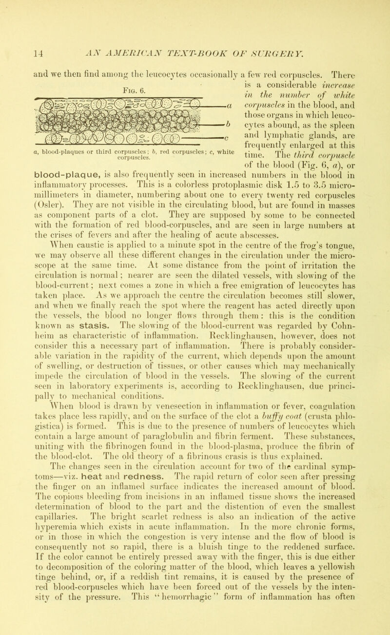 and we then find among the leucocytes occasionally a few red corpuscles. There is a considerable increase- in the number of white corpuscles in the blood, and those organs in which leuco- cytes abound, as the spleen and lymphatic glands, are frequently enlarged at this a, blood-plaques or third corpuscles; 6, red corpuscles; c, white time# The tMrd corpu%de of the blood (Fig. 6, a), or blood-plaque, is also frequently seen in increased numbers in the blood in inflammatory processes. This is a colorless protoplasmic disk 1.5 to 3.5 micro- millimeters in diameter, numbering about one to every twenty red corpuscles (Osier). They are not visible in the circulating blood, but are found in masses as component parts of a clot. They are supposed by some to be connected with the formation of red blood-corpuscles, and are seen in large numbers at the crises of fevers and after the healing of acute abscesses. When caustic is applied to a minute spot in the centre of the frog’s tongue, we may observe all these different changes in the circulation under the micro- scope at the same time. At some distance from the point of irritation the circulation is normal; nearer are seen the dilated vessels, with slowing of the blood-current; next comes a zone in which a free emigration of leucocytes has taken place. As we approach the centre the circulation becomes still slower, and when we finally reach the spot where the reagent has acted directly upon the vessels, the blood no longer flows through them : this is the condition known as stasis. The slowing of the blood-current was regarded by Cohn- heim as characteristic of inflammation. Recklinghausen, however, does not consider this a necessary part of inflammation. There is probably consider- able variation in the rapidity of the current, which depends upon the amount of swelling, or destruction of tissues, or other causes which may mechanically impede the circulation of blood in the vessels. The slowing of the current seen in laboratory experiments is, according to Recklinghausen, due princi- pally to mechanical conditions. When blood is drawn by venesection in inflammation or fever, coagulation takes place less rapidly, and on the surface of the clot a huffy coat (crusta phlo- gistica) is formed. This is due to the presence of numbers of leucocytes which contain a large amount of paraglobulin and fibrin ferment. These substances, uniting with the fibrinogen found in the blood-plasma, produce the fibrin of the blood-clot. The old theory of a fibrinous crasis is thus explained. The changes seen in the circulation account for two of the cardinal symp- toms—viz. heat and redness. The rapid return of color seen after pressing the finger on an inflamed surface indicates the increased amount of blood. The copious bleeding from incisions in an inflamed tissue shows the increased determination of blood to the part and the distention of even the smallest capillaries. The bright scarlet redness is also an indication of the active hyperemia which exists in acute inflammation. In the more chronic forms, or in those in which the congestion is very intense and the flow of blood is consequently not so rapid, there is a bluish tinge to the reddened surface. If the color cannot be entirely pressed away with the finger, this is due either to decomposition of the coloring matter of the blood, which leaves a yellowish tinge behind, or, if a reddish tint remains, it is caused by the presence of red blood-corpuscles which have been forced out of the vessels by the inten- sity of the pressure. This “ hemorrhagic ” form of inflammation has often Fig. 6.
