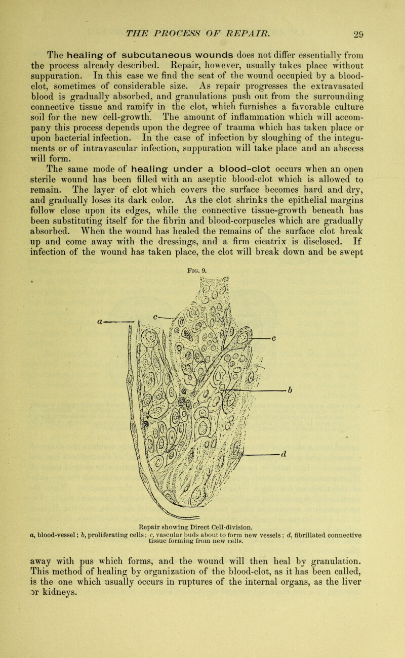 The healing of subcutaneous wounds does not differ essentially from the process already described. Repair, however, usually takes place without suppuration. In this case we find the seat of the wound occupied by a blood- clot, sometimes of considerable size. As repair progresses the extravasated blood is gradually absorbed, and granulations push out from the surrounding connective tissue and ramify in the clot, which furnishes a favorable culture soil for the new cell-growth. The amount of inflammation which will accom- pany this process depends upon the degree of trauma which has taken place or upon bacterial infection. In the case of infection by sloughing of the integu- ments or of intravascular infection, suppuration will take place and an abscess will form. The same mode of healing under a blood-clot occurs when an open sterile wound has been filled with an aseptic blood-clot which is allowed to remain. The layer of clot which covers the surface becomes hard and dry, and gradually loses its dark color. As the clot shrinks the epithelial margins follow close upon its edges, while the connective tissue-growth beneath has been substituting itself for the fibrin and blood-corpuscles which are gradually absorbed. When the wound has healed the remains of the surface clot break up and come away wTith the dressings, and a firm cicatrix is disclosed. If infection of the wound has taken place, the clot will break down and be swept Fig. 9. Repair showing Direct Cell-division. a, blood-vessel; b, proliferating cells; c, vascular buds about to form new vessels; d, fibrillated connective tissue forming from new cells. away with pus which forms, and the wound will then heal by granulation. This method of healing by organization of the blood-clot, as it has been called, is the one which usually occurs in ruptures of the internal organs, as the liver or kidneys.