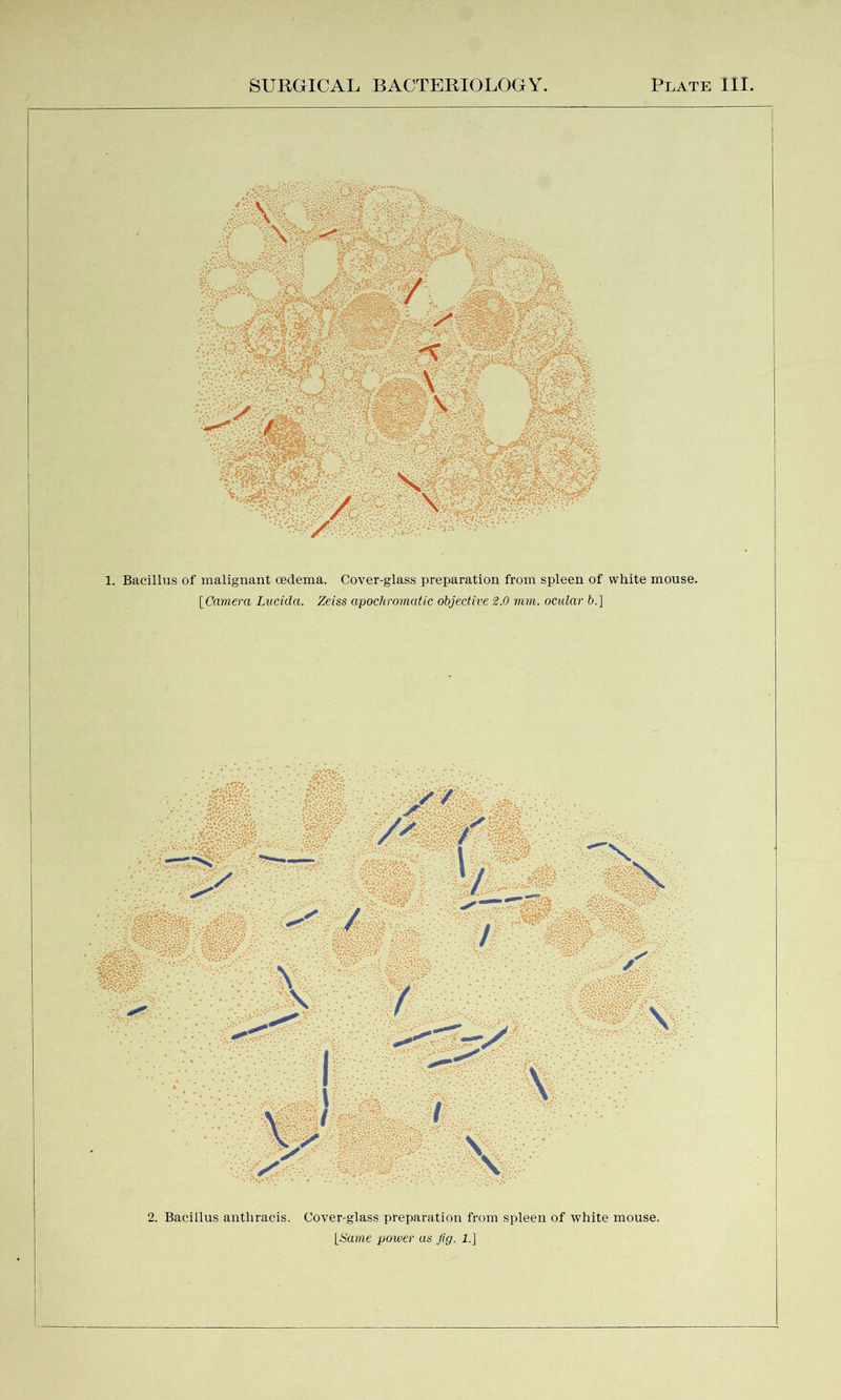1. Bacillus of malignant oedema. Coyer-glass preparation from spleen of white mouse. [Camera Lucida. Zeiss apochromatic objective 2.0 mm. ocular b.] 2. Bacillus antliracis. Cover-glass preparation from spleen of white mouse. LSame power as fig. 1.]