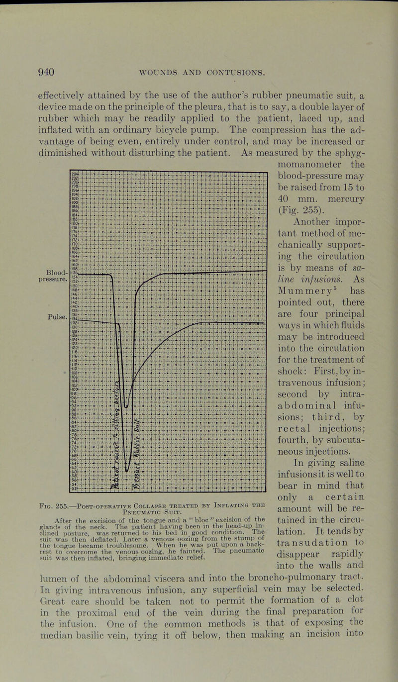 effectively attained the use of the author’s rubber pneumatic suit, a device made on the principle of the pleura, that is to say, a double layer of rubber which may be readily applied to the patient, laced up, and inflated with an ordinary bicycle pump. The compression has the ad- vantage of being even, entirely under control, and may be increased or diminished without disturbing the patient. As measured by the sphyg- momanometer the blood-pressure may be raised from 15 to 40 mm. mercury (Fig. 255). Another impor- tant method of me- chanically support- ing the circulation is by means of sa- line infusions. As Mummery^ has pointed out, there are four principal ways in which fluids may be introduced into the circulation for the treatment of shock; First,by in- travenous infusion; second by intra- abdominal infu- sions ; third, by rectal injections; fourth, by subcuta- neous injections. In giving saline infusions it is well to bear in mind that only a certain amount will be re- tained in the circu- lation. It tends by transudation to disappear rapidly into the walls and Fig. 255.—Post-operative Collapse treated by Inflating the Pneumatic Suit. After the excision of the tongue and a “ bloc ” excision of the glands of the neck. The patient having been in the head-up in- clined posture, was returned to his bed in good condition. The .suit was then deflated. Later a venous oozing from the stump of the tongue became troublesome. When he was put upon a back- rest to overcome the venous oozing, he fainted. The pneumatic suit was then inflated, bringing immediate relief. lumen of the abdominal viscera and into the broncho-pulmonary tract. In giving intravenous infusion, any superficial vein may be selected, tlreat care should be taken not to permit the formation of a clot in the proximal end of the vein during the final preparation for the infusion. One of the common methods is that of exposing the median basilic vein, tying it off below, then making an incision into