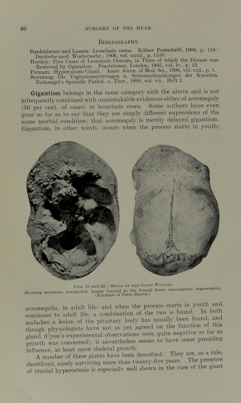 Bibliography. Bardenheuer and Lossen: Leontiasis ossea. Ivolner Festschrift, 1904, p. 154 . Deutsche med. Wochenschr., 1906, vol. xxxii., p. 1518. Horsley: Five Cases of Leontiasis Osseum, in Three of which the Disease was Removed by Operation. Practitioner, London, 1895, vol. lv., p. 12. Putnam: Hyperostosis Cranii. Amer. Journ. of Med. Sci., 1896, vol. cxii., p. 1. Sternberg: Die Vegitationsstorungen u. Systemerkrankungen der Knochen. Nothnagel’s Specielle Pathol, u. Ther., 1899, vol. vii., Hett 2. Gigantism belongs in the same category with the above and is not infrequently combined with unmistakable evidences either of acromegaly (50 per cent, of cases) or leontiasis ossea. Some authors have even gone so far as to say that they are simply different expressions of the same morbid condition; that acromegaly is merely delayed gigantism. Gigantism, in other words, occurs when the process starts in youth, Showing enormous Figs. 21 and 22.—Skull of the Giant Wilkins. .growth largely limited to the frontal bone; sarcomatous degeneration. flCinrlnPSS of PctGT BeISSOG.) acromegalia, in adult life: and when the process starts in youth and continues to adult life, a combination of the two is omul In both maladies a lesion of the pituitary body has usually been found, and though physiologists have not as yet agreed on the function of t p-land (Cyon’s experimental observations were quite negative so growth was concerned), it nevertheless seems to have some presiding influence, at least upon skeletal growth A number of these giants have been described. 1 hey Me, as a rule shortlived, rarely surviving more than twenty-five years. i P of cranial hyperostosis is especially well shown in the case of g 1