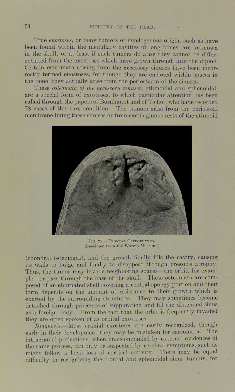True enostoses, or bony tumors of myelogenous origin, such as have been found within the medullary cavities of long bones, are unknown in the skull, or at least if such tumors do arise they cannot be differ- entiated from the exostoses which have grown through into the diploe. Certain osteomata arising from the accessory sinuses have been incor- rectly termed enostoses, for though they are enclosed within spaces in the bone, they actually arise from the periosteum of the sinuses. These osteomata of the accessory sinuses, ethmoidal and sphenoidal, are a special form of exostoses, to which particular attention has been called through the papers of Bornhaupt and of Tichof, who have recorded 78 cases of this rare condition. The tumors arise from the periosteal membrane lining these sinuses or from cartilaginous rests of the ethmoid Fig. 27.—Frontal Osteophytes. (Specimen from the Warren Museum.) (chondral osteomata), and the growth finally fills the cavity, causing its walls to bulge and finally to disappear through pressure atrophy. Thus, the tumor may invade neighboring spaces—the orbit, for exam- ple—or pass through the base of the skull. These osteomata are com- posed of an eburnated shell covering a central spongy portion and their form depends on the amount of resistance to their growth which is exerted by the surrounding structures. They may sometimes become detached through processes of suppuration and fill the distended sinus as a foreign body. From the fact that the orbit is frequently invaded they are often spoken of as orbital exostoses. Diagnosis.—Most cranial exostoses are easily recognized, though early in their development they may be mistaken for sarcomata. The intracranial projections, when unaccompanied by external evidences of the same process, can only be suspected by cerebral symptoms,^such as might follow a local loss of cortical activity. There may be equal difficulty in recognizing the frontal and sphenoidal sinus tumors, for