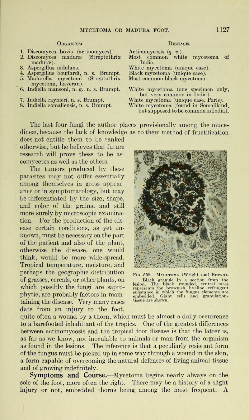 Organism. 1. Discomyces bovis (actinomyces). 2. Discomyces madurse (Streptothrix madurse). 3. Aspergillus nidulans. 4. Aspergillus bouffardi, n. s. Brumpt. 5. Madurella mycetomi (Streptothrix mycetomi, Laveran). 6. Indiella mansoni, n. g., n. s. Brumpt. 7. Indiella raynieri, n. s. Brumpt. 8. Indiella somaliensis, n. s. Brumpt, Disease. Actinomycosis (q. v.). Most common white mycetoma of India. White mycetoma (unique case). Black mycetoma (unique case). Most common black mycetoma. White mycetoma (one specimen only, but very common in India). White mycetoma (unique case, Paris). White mycetoma (found in Somaliland, but supposed to be common in India). rmm The last four fungi the author places provisionally among the muce- dinese, because the lack of knowledge as to their method of fructification does not entitle them to be ranked otherwise, but he believes that future research will prove these to be as- comycetes as well as the others. The tumors produced by these parasites may not differ essentially among themselves in gross appear- ance or in symptomatology, but may be differentiated by the size, shape, and color of the grains, and still more surely by microscopic examina- tion. For the production of the dis- ease certain conditions, as yet un- known, must be necessary on the part of the patient and also of the plant, otherwise the disease, one would think, would be more wide-spread. Tropical temperature, moisture, and perhaps the geographic distribution of grasses, cereals, or other plants, on which possibly the fungi are sapro- phytic, are probably factors in main- taining the disease. Very many cases date from an injury to the foot, quite often a wound by a thorn, which must be almost a daily occurrence to a barefooted inhabitant of the tropics. One of the greatest differences between actinomycosis and the tropical foot disease is that the latter is, as far as we know, not inoculable to animals or man from the organism as found in the lesions. The inference is that a peculiarly resistant form of the fungus must be picked up in some way through a wound in the skin, a form capable of overcoming the natural defenses of living animal tissue and of growing indefinitely. Symptoms and Course.—Mycetoma begins nearly always on the sole of the foot, more often the right. There may be a history of a slight injury or not, embedded thorns being among the most frequent. A Fig. 558.—Mycetoma (Wright and Brown). Black granule in a section from the lesion. The black, rounded, central mass represents the brownish, hyaline, refringent substance in which the fungus elements are embedded. Giant cells and granulation- tissue are shown.