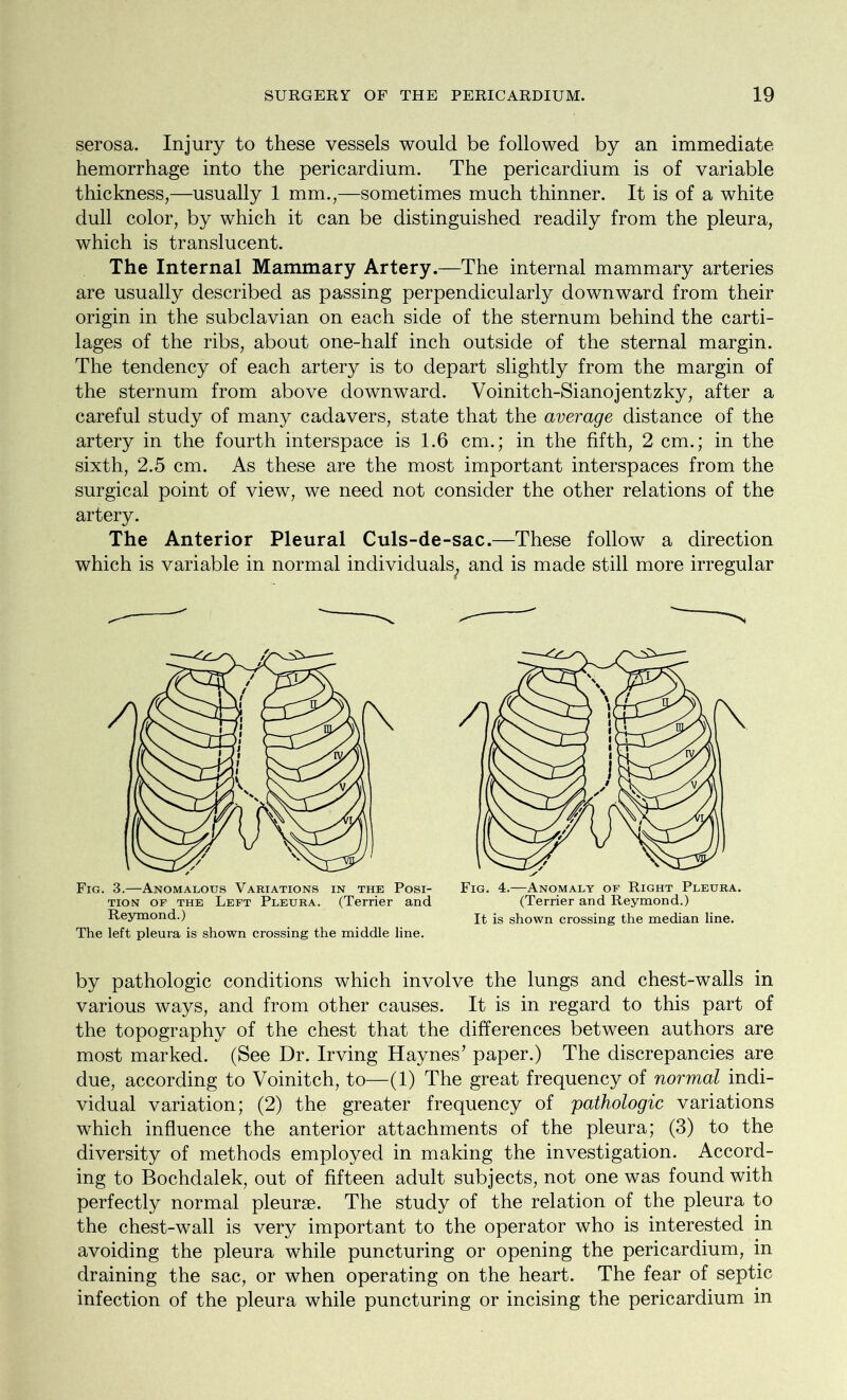 serosa. Injury to these vessels would be followed by an immediate hemorrhage into the pericardium. The pericardium is of variable thickness,—usually 1 mm.,—sometimes much thinner. It is of a white dull color, by which it can be distinguished readily from the pleura, which is translucent. The Internal Mammary Artery.—The internal mammary arteries are usually described as passing perpendicularly downward from their origin in the subclavian on each side of the sternum behind the carti- lages of the ribs, about one-half inch outside of the sternal margin. The tendency of each artery is to depart slightly from the margin of the sternum from above downward. Voinitch-Sianojentzky, after a careful study of many cadavers, state that the average distance of the artery in the fourth interspace is 1.6 cm.; in the fifth, 2 cm.; in the sixth, 2.5 cm. As these are the most important interspaces from the surgical point of view, we need not consider the other relations of the artery. The Anterior Pleural Culs-de-sac.—These follow a direction which is variable in normal individuals^ and is made still more irregular Fig. 3.—Anomalous Variations in the Posi- tion of the Left Pleura. (Terrier and Reymond.) The left pleura is shown crossing the middle line. Fig. 4.—Anomaly of Right Pleura. (Terrier and Reymond.) It is shown crossing the median line. by pathologic conditions which involve the lungs and chest-walls in various ways, and from other causes. It is in regard to this part of the topography of the chest that the differences between authors are most marked. (See Dr. Irving Haynes’ paper.) The discrepancies are due, according to Voinitch, to—(1) The great frequency of normal indi- vidual variation; (2) the greater frequency of pathologic variations which influence the anterior attachments of the pleura; (3) to the diversity of methods employed in making the investigation. Accord- ing to Bochdalek, out of fifteen adult subjects, not one was found with perfectly normal pleurae. The study of the relation of the pleura to the chest-wall is very important to the operator who is interested in avoiding the pleura while puncturing or opening the pericardium, in draining the sac, or when operating on the heart. The fear of septic infection of the pleura while puncturing or incising the pericardium in