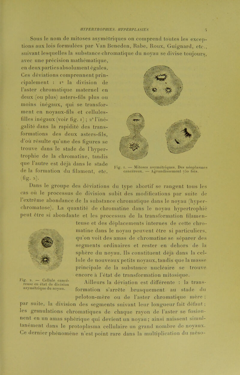 Sous le nom de mitoses asymétriques on comprend toutes les excep- tions aux lois formulées par Van Beneden, Rabe, Roux, Guignard, etc. suivant lesquelles la substance cbr avec une précision mathématique, en deux parties absolument égales. Ces déviations comprennent prin- cipalement : i° la division de l’aster chromatique maternel en deux (ou plus) asters-fils plus ou moins inégaux, qui se transfor- ment en noyaux-fils et cellules- filles inégaux (voir fig. i) ; 20 l'iné- galité dans la rapidité des trans- formations des deux asters-fils, d’où résulte qu'une des figures se trouve dans le stade de l'hyper- trophie de la chromatine, tandis que 1 autre est déjà dans le stade de la formation du filament, etc. ,fig- 2)- matique du noyau se divise toujours, Fig. 1. — Mitoses asymétriques. Des néoplasmes cancéreux. — Agrandissement 700 lois. - •- î' A. -i -î- . Dans le groupe des déviations du type abortif se rangent tous les cas où le processus de division subit des modifications par suite de 1 extrême abondance de la substance chromatique dans le noyau (hvper- chromatose). La quantité de chromatine dans le noyau hypertrophié peut être si abondante et les processus de la transformation filamen- teuse et des déplacements internes de celte chro- matine dans le noyau peuvent être si particuliers, qu’on voit des amas de chromatine se séparer des segments ordinaires et rester en dehors de la sphère du noyau. Ils constituent déjà dans la cel- lule de nouveaux petits noyaux, tandis que la niasse principale de la substance nucléaire se trouve encore à l’état de transformation milosique. Ailleurs la déviation est différente : la trans- formation s’arrête brusquement au stade du peloton-mère ou de l’aster chromatique mère ; par suite, la division des segments suivant leur longueur fait défaut ; les granulations chromatiques de chaque rayon de l’aster se fusion- nent en un amas sphérique qui devient un noyau; ainsi naissent simul- tanément dans le protoplasma cellulaire un grand nombre de noyaux. Ce dernier phénomène n’est point rare dans la multiplication du méso- m se -îfev- • Fig. 2. — Cellule cancé- reuse en état de division asymétrique du noyau.