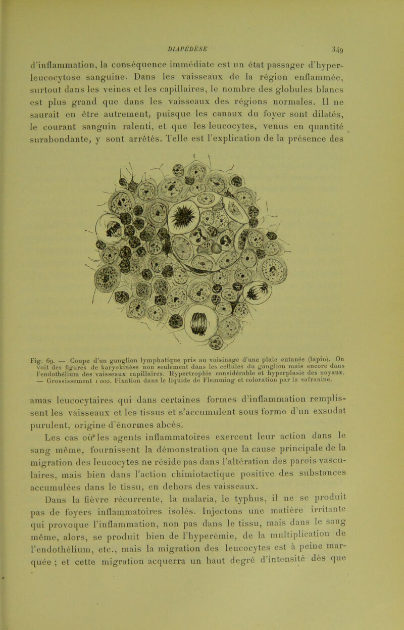 d'inflammation, la conséquence immédiate est un état passager d’hyper- leucocytose sanguine. Dans les vaisseaux de la région enflammée, surtout dans les veines et les capillaires, le nombre des globules blancs est plus grand que dans les vaisseaux des régions normales. 11 ne saurait en être autrement, puisque les canaux du foyer sont dilatés, le courant sanguin ralenti, et que les leucocytes, venus en quantité surabondante, y sont arrêtés. Telle est l’explication de la présence des Fig. 6y. — Coupe d’un ganglion lymphatique pris au voisinage d’une plaie cutanée (lapin). On voit des figures de karyokinèse non seulement dans les cellules du ganglion mais encore dans l’endothélium des vaisseaux capillaires. Hypertrophie considérable et hyperplasie des noyaux. — Grossissement i ooo. Fixation dans le liquide de Flemming et coloration par la safranine. amas leucocytaires qui dans certaines formes d’inflammation remplis- sent les vaisseaux et les tissus et s’accumulent sous forme d un exsudât purulent, origine d'énormes abcès. Les cas où'les agents inflammatoires exercent leur action dans le sang même, fournissent la démonstration que la cause principale de la migration des leucocytes ne réside pas dans l’altération des parois vascu- laires, mais bien dans l’action chimiotactique positive des substances accumulées dans le tissu, en dehors des vaisseaux. Dans la fièvre récurrente, la malaria, le typhus, il ne se produit pas de foyers inflammatoires isolés. Injectons une matière irritante qui provoque l’inflammation, non pas dans le tissu, mais dans le sang même, alors, se produit bien de l’hyperémie, de la multiplication de l’endothélium, etc., mais la migration des leucocytes est a peine mar- quée ; et cette migration acquerra un haut degré d’intensité dès que