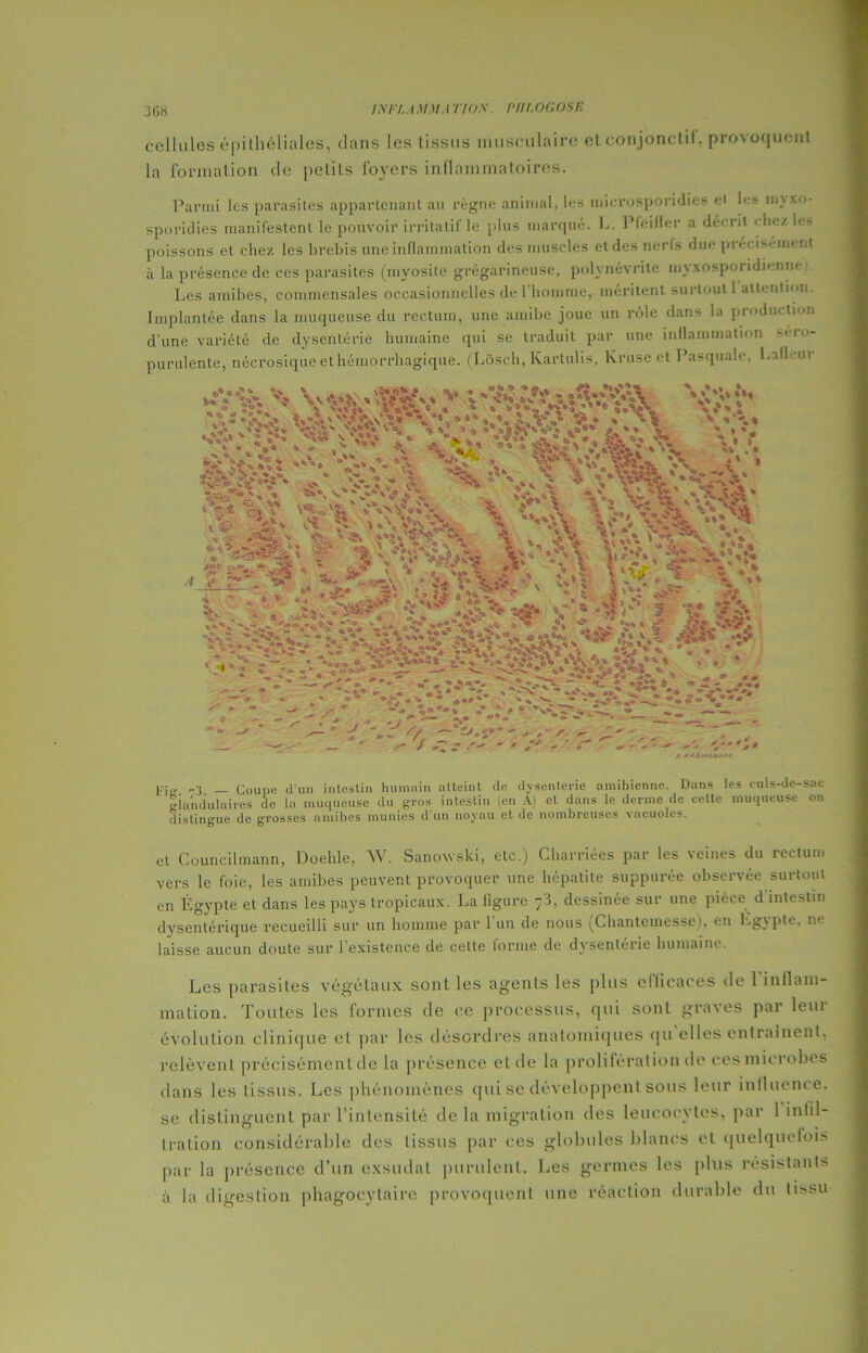 cellules épithéliales, clans les tissus musculaire el conjonctif, provoquent la formation de peLits foyers inflammatoires. Parmi les parasites appartenant au règne animal, les microsporidies el les mx.xo- sporidies manifestent le pouvoir irritatif le plus marqué. L. Pfeiffer a décrit « liez les poissons et chez les brebis une inflammation des muscles et des nerfs due précisément à la présence de ces parasites (myosite grégarineuse, polynévrite myxosporidierme Les amibes, commensales occasionnelles de 1 homme, méritent surtout 1 attention. Implantée dans la muqueuse du rectum, une amibe joue un rôle dans la production d’une variété de dysenlérie humaine qui se traduit par une inflammation sero- purulente, nécrosique et hémorrhagique. (Lôsch, Ivartulis, lvruse et Pasquale, hall -ut s -3 _ Coupe d'un intosliu humain atteint de dysenterie amibienne. Dans les culs-de-sac glandulaires de la muqueuse du gros intestin (en A) et dans le derme de celte muqueuse on distingue de grosses amibes munies d un noyau et de nombreuses \acuoles. et Councilmann, Doehle, W. Sanovski, etc.) Charriées par les veines du rectum vers le foie, les amibes peuvent provoquer une hépatite suppurée observée surtout en Égypte et dans les pays tropicaux. La figure 7.I, dessinée sur une pièce d'intestin dysentérique recueilli sur un homme par l'un de nous (Chantemesse), en Egypte, ne laisse aucun doute sur l’existence de cette forme de dysenterie humaine. Les parasites végétaux sont les agents les plus efficaces de l'inflam- mation. Toutes les formes de ce processus, qui sont graves par leur évolution clinique eL par les désordres anatomiques qu elles entraînent, relèvent précisément de la présence et de la prolilération de ces microbes clans les tissus. Les phénomènes qui se développent sous leur influence, se distinguent par l’intensité delà migration des leucocytes, par 1 infil- tration considérable des tissus par ces globules blancs et quelquefois par la présence d’un exsudât purulent. Les germes les plus résistants à la digestion phagocytaire provoquent une réaction durable du lissu