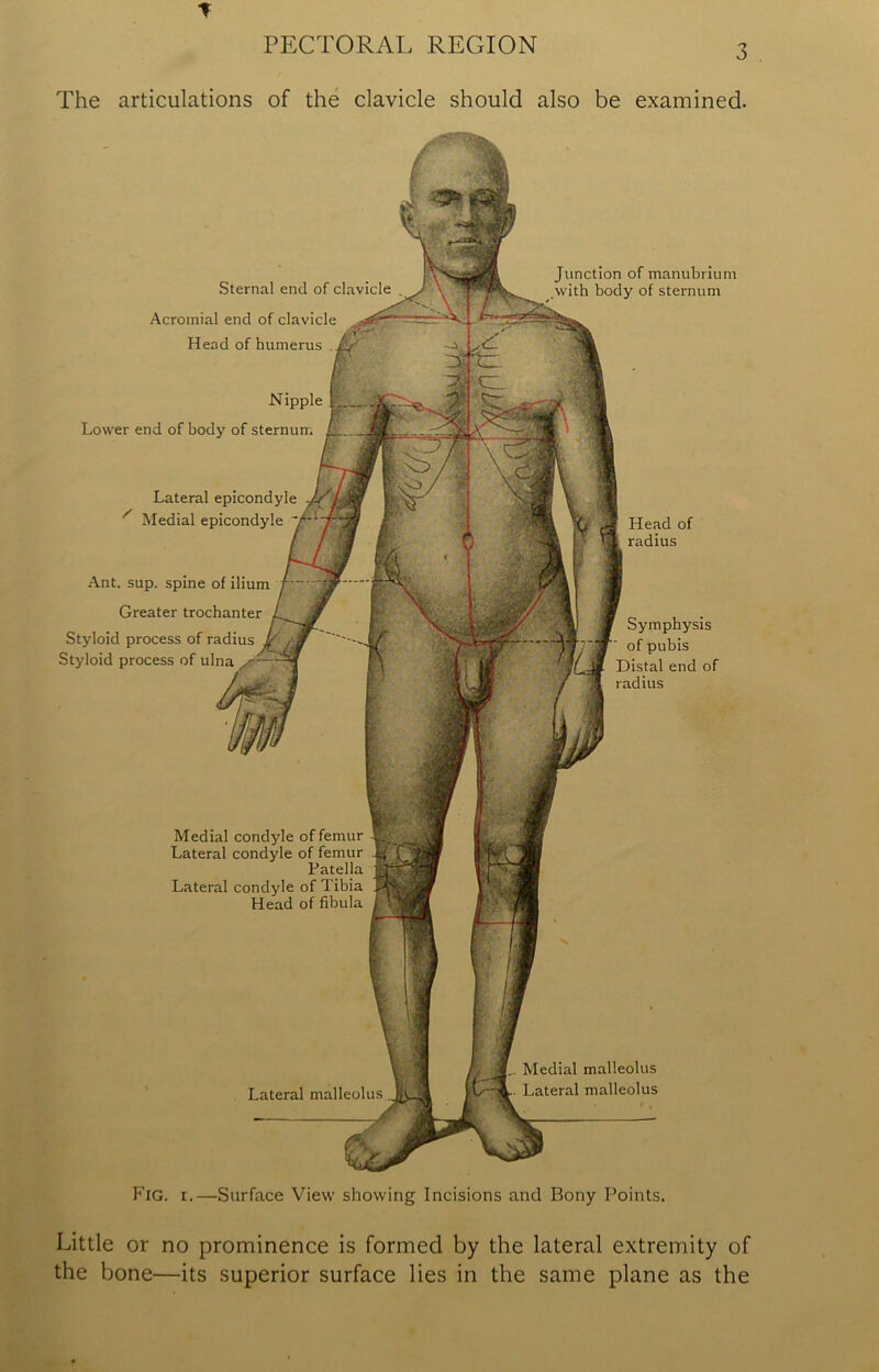 PECTORAL REGION The articulations of the clavicle should also be examined. Fig. i.—Surface View showing Incisions and Bony Points. Medial malleolus Lateral malleolus Sternal end of clavicle Acromial end of clavicle Head of humerus Nipple Lower end of body of sternum Lateral epicondyle x Medial epicondyle Ant. sup. spine of ilium Greater trochanter Styloid process of radius Styloid process of ulna Medial condyle of femur Lateral condyle of femur Patella Lateral condyle of Tibia Head of fibula Lateral malleolus Junction of manubrium with body of sternum Head of radius Symphysis of pubis Distal end of radius Little or no prominence is formed by the lateral extremity of the bone—its superior surface lies in the same plane as the