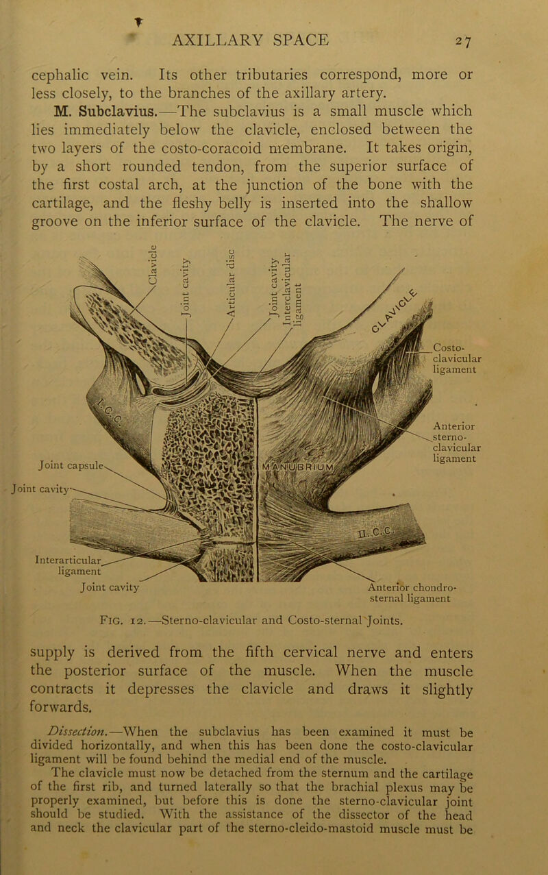 f AXILLARY SPACE 27 cephalic vein. Its other tributaries correspond, more or less closely, to the branches of the axillary artery. M. Subclavius.—The subclavius is a small muscle which lies immediately below the clavicle, enclosed between the two layers of the costo-coracoid membrane. It takes origin, by a short rounded tendon, from the superior surface of the first costal arch, at the junction of the bone with the cartilage, and the fleshy belly is inserted into the shallow groove on the inferior surface of the clavicle. The nerve of Costo- clavicular ligament Anterior sterno- clavicular ligament Interarticular ligament Joint cavity Anterior chondro- sternal ligament Fig. 12.—Sternoclavicular and Costo-sternalNJoints. supply is derived from the fifth cervical nerve and enters the posterior surface of the muscle. When the muscle contracts it depresses the clavicle and draws it slightly forwards. Dissection.—When the subclavius has been examined it must be divided horizontally, and when this has been done the costo-clavicular ligament will be found behind the medial end of the muscle. The clavicle must now be detached from the sternum and the cartilage of the first rib, and turned laterally so that the brachial plexus may be properly examined, but before this is done the sterno-clavicular joint should be studied. With the assistance of the dissector of the head and neck the clavicular part of the sterno-cleido-mastoid muscle must be