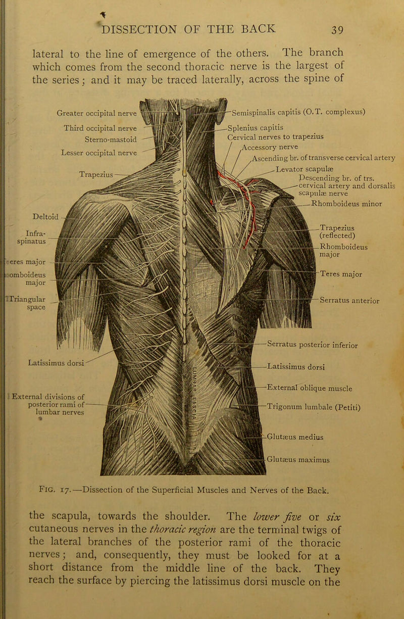 * lateral to the line of emergence of the others. The branch which comes from the second thoracic nerve is the largest of the series; and it may be traced laterally, across the spine of Latissimus dorsi External divisions of posterior rami of lumbar nerves Serratus anterior Serratus posterior inferior Latissimus dorsi External oblique muscle Trigonum lumbale (Petiti) Deltoid Infra- spinatus teres major omboideus major I Triangular space Semispinalis capitis (O.T. complexus) capitis Cervical nerves to trapezius nerve g br. of transverse cervical artery Levator scapulas Descending br. of trs. cervical artery and dorsalis scapulae nerve Rhomboideus minor Trapezius (reflected) Rhomboideus major Teres major tseus medius Glutaeus maximus Greater occipital nerve Third occipital nerve Sterno-mastoid Lesser occipital nerve Fig. i7.—Dissection of the Superficial Muscles and Nerves of the Back. the scapula, towards the shoulder. The lower five or six cutaneous nerves in the thoracic region are the terminal twigs of the lateral branches of the posterior rami of the thoracic nerves; and, consequently, they must be looked for at a short distance from the middle line of the back. They reach the surface by piercing the latissimus dorsi muscle on the