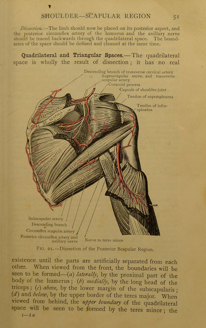 T SHOULDER—SCAPULAR REGION 51 Dissection.—The limb should now be placed on its posterior aspect, and the posterior circumflex artery of the humerus and the axillary nerve should be traced backwards through the quadrilateral space. The bound- aries of the space should be defined and cleaned at the same time. Quadrilateral and Triangular Spaces.—The quadrilateral space is wholly the result of dissection; it has no real Descending branch of transverse cervical artery Suprascapular nerve, and transverse scapular artery Coracoid process Capsule of shoulder-joint Tendon of supra'spinatus Tendtm of infra- spinatus Subscapular artery Descending branch Circumflex scapulse artery Posterior circumflex artery an axillary nerv Nerve to teres minor Fig. 21.—Dissection of the Posterior Scapular Region. existence until the parts are artificially separated from each other. When viewed from the front, the boundaries will be seen to be formed—(a) laterally, by the proximal part of the body of the humerus; (b) medially, by the long head of the triceps; (c) above, by the lower margin of the subscapularis ; Of) and below, by the upper border of the teres major. When viewed from behind, the upper boundary of the quadrilateral space will be seen to be formed by the teres minor • the I—4 a ’