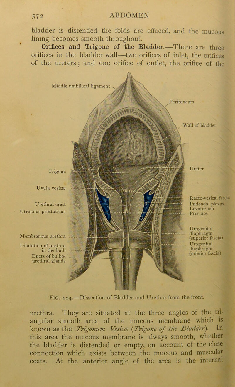 bladder is distended the folds are effaced, and the mucous lining becomes smooth throughout. Orifices and Trigone of the Bladder.—There are three orifices in the bladder wall—two orifices of inlet, the orifices of the ureters ; and one orifice of outlet, the orifice of the Middle Trigone Uvula vesicae Urethral crest Utriculus prostaticus Membranous urethra Dilatation of urethra in the bulb Ducts of bulbo- urethral glands umbilical ligament Peritoneum Wall of bladder Recto-vesical fascia Pudendal plexus Levator ani Prostate Urogenital diaphragm (superior fascia) Urogenital diaphragm (inferior fascia) Fig. 224.—Dissection of Bladder and Urethra from the front. urethra. They are situated at the three angles of the tri- angular smooth area of the mucous membrane which is known as the Trigonum Vesica (Trigone of the Bladder). In this area the mucous membrane is always smooth, whether the bladder is distended or empty, on account of the close connection which exists between the mucous and muscular coats. At the anterior angle of the area is the internal