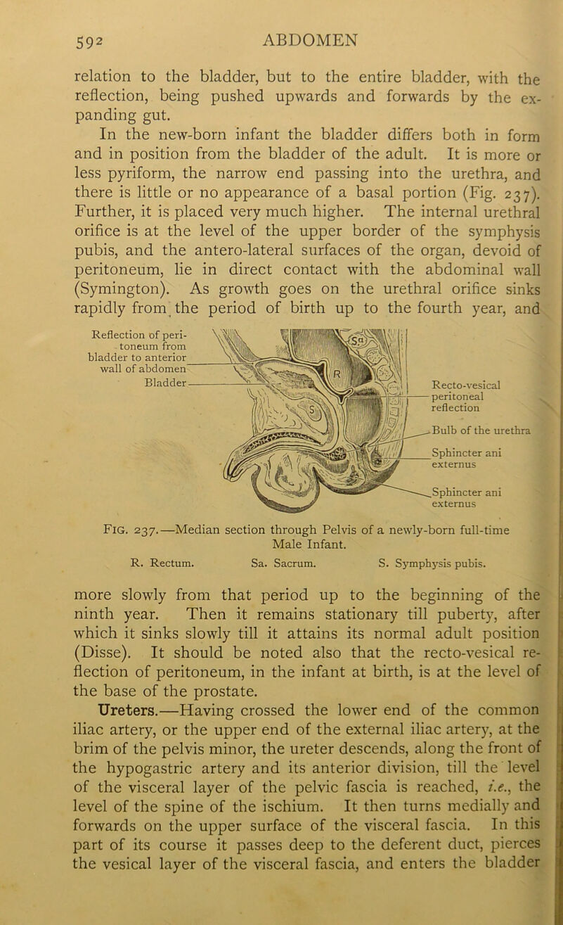 relation to the bladder, but to the entire bladder, with the reflection, being pushed upwards and forwards by the ex- panding gut. In the new-born infant the bladder differs both in form and in position from the bladder of the adult. It is more or less pyriform, the narrow end passing into the urethra, and there is little or no appearance of a basal portion (Fig. 237). Further, it is placed very much higher. The internal urethral orifice is at the level of the upper border of the symphysis pubis, and the antero-lateral surfaces of the organ, devoid of peritoneum, lie in direct contact with the abdominal wall (Symington). As growth goes on the urethral orifice sinks rapidly from the period of birth up to the fourth year, and Recto-vesical peritoneal reflection Bulb of the urethra Sphincter ani externus Sphincter ani externus Fig. 237.—Median section through Pelvis of a newly-born full-time Male Infant. R. Rectum. Sa. Sacrum. S. Symphysis pubis. more slowly from that period up to the beginning of the ninth year. Then it remains stationary till puberty, after which it sinks slowly till it attains its normal adult position (Disse). It should be noted also that the recto-vesical re- flection of peritoneum, in the infant at birth, is at the level of the base of the prostate. Ureters.—Having crossed the lower end of the common iliac artery, or the upper end of the external iliac artery, at the brim of the pelvis minor, the ureter descends, along the front of the hypogastric artery and its anterior division, till the level of the visceral layer of the pelvic fascia is reached, /.<?., the level of the spine of the ischium. It then turns medially and forwards on the upper surface of the visceral fascia. In this part of its course it passes deep to the deferent duct, pierces the vesical layer of the visceral fascia, and enters the bladder Reflection of peri- toneum from bladder to anterior wall of abdomen Bladder