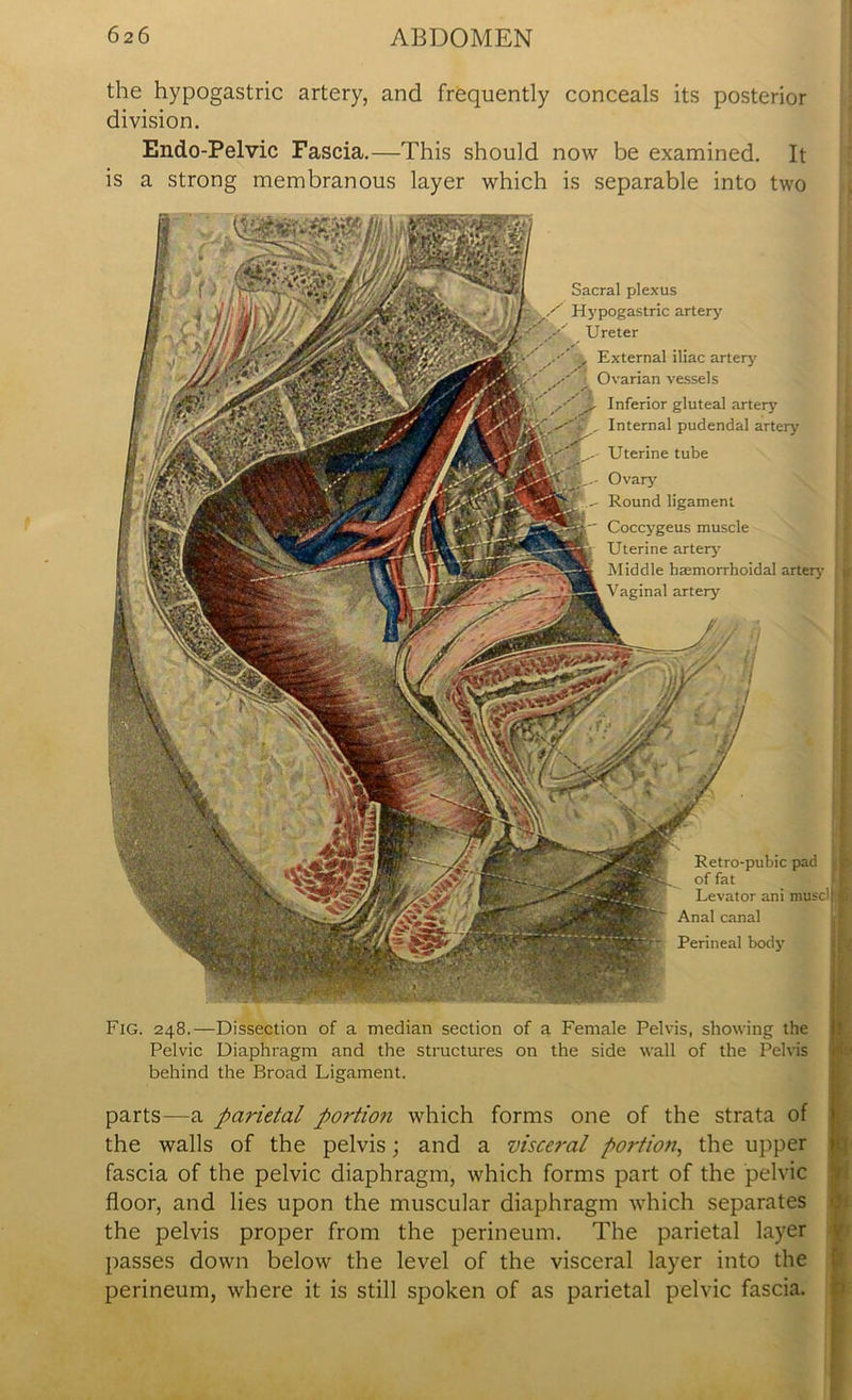 the hypogastric artery, and frequently conceals its posterior division. Endo-Pelvic Fascia.—This should now be examined. It is a strong membranous layer which is separable into two Retro-pubic pad of fat Levator ani musdj Fig. 248.—Dissection of a median section of a Female Pelvis, showing the Pelvic Diaphragm and the structures on the side wall of the Pelvis behind the Broad Ligament. parts—a parietal portion which forms one of the strata of the walls of the pelvis; and a visceral portion, the upper fascia of the pelvic diaphragm, which forms part of the pelvic floor, and lies upon the muscular diaphragm which separates the pelvis proper from the perineum. The parietal layer passes down below the level of the visceral layer into the perineum, where it is still spoken of as parietal pelvic fascia. Sacral plexus / Hypogastric artery Ureter External iliac artery' Ovarian vessels Ovary' Round ligament Coccygeus muscle Uterine artery' Middle baemorrhoidal artery Vaginal artery' Anal canal Perineal body' Inferior gluteal artery Internal pudendal artery Uterine tube