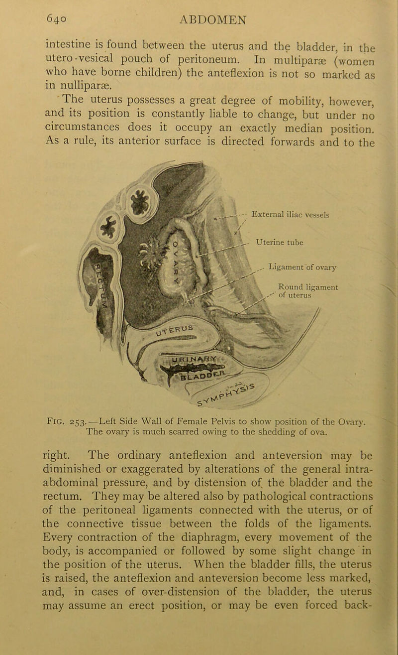 intestine is found between the uterus and the bladder, in the utero-vesical pouch of peritoneum. In multiparse (women who have borne children) the anteflexion is not so marked as in nulliparse. The uterus possesses a great degree of mobility, however, and its position is constantly liable to change, but under no circumstances does it occupy an exactly median position. As a rule, its anterior surface is directed forwards and to the Fig. 253.—Left Side Wall of Female Pelvis to show position of the Ovary. The ovary is much scarred owing to the shedding of ova. right. The ordinary anteflexion and anteversion may be diminished or exaggerated by alterations of the general intra- abdominal pressure, and by distension of the bladder and the rectum. They may be altered also by pathological contractions of the peritoneal ligaments connected with the uterus, or of the connective tissue between the folds of the ligaments. Every contraction of the diaphragm, every movement of the body, is accompanied or followed by some slight change in the position of the uterus. When the bladder fills, the uterus is raised, the anteflexion and anteversion become less marked, and, in cases of over-distension of the bladder, the uterus may assume an erect position, or may be even forced back-