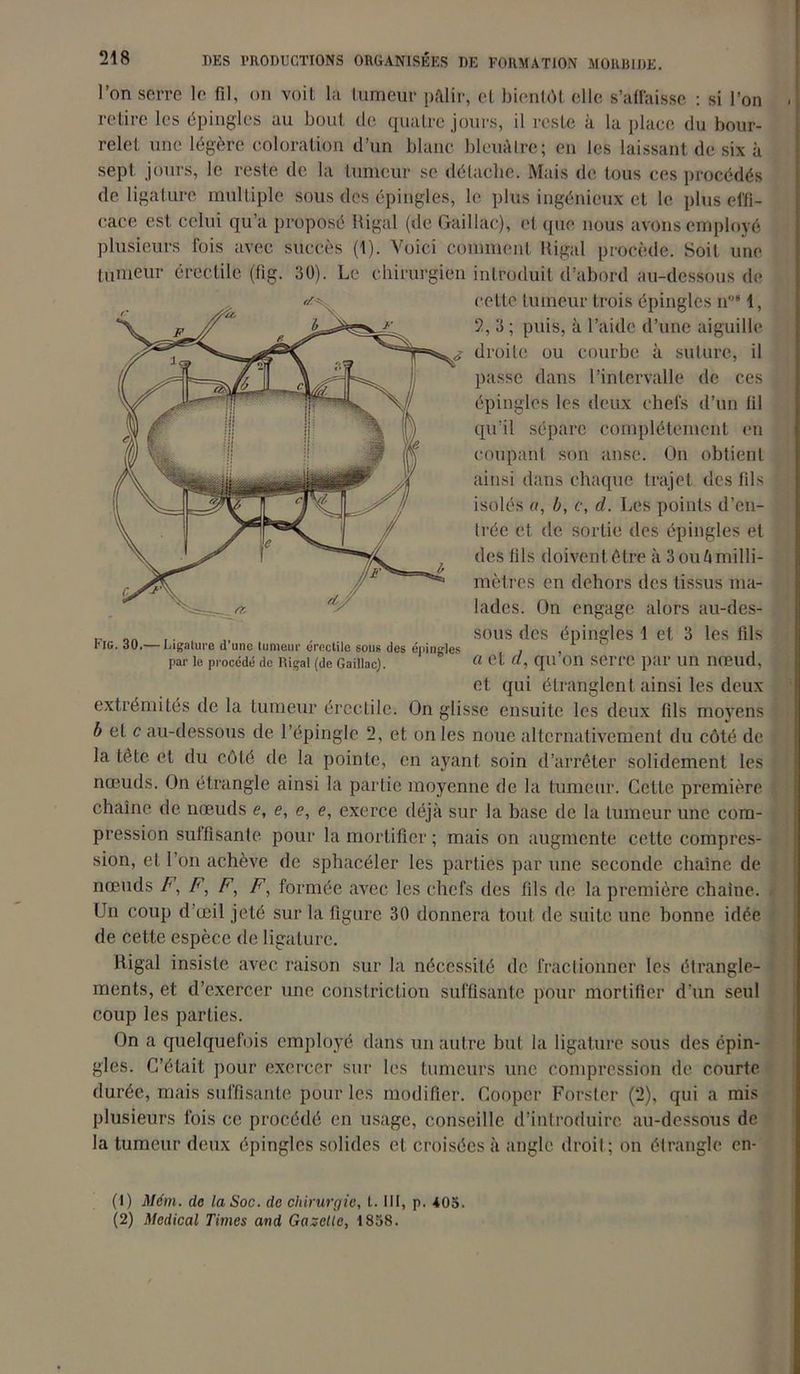 l’on serre le fil, on voit la tumeur pâlir, et bientôt elle s’affaisse : si l’on . retire les épingles au bout cle quatre jours, il reste à la place du bour- relet une légère coloration d’un blanc bleuâtre; en les laissant de six à sept jours, le reste de la tumeur se détache. Mais de tous ces procédés de ligature multiple sous des épingles, le plus ingénieux et le plus effi- cace est celui qu’a proposé Rigal (de Gaillac), et que nous avons employé plusieurs fois avec succès (î). Voici comment ltigal procède. Soit une tumeur érectile (fig. 30). Le chirurgien introduit d’abord au-dessous de cette tumeur trois épingles n'” 1, 2, 3 ; puis, à l’aide d’une aiguille droite ou courbe à suture, il passe dans l’intervalle de ces épingles les deux chefs d’un fil qu’il sépare complètement en coupant son anse. On obtient ainsi dans chaque trajet des fils isolés «, b, c, d. Les points d’en- trée et de sortie des épingles et des fils doivent être à 3 ou h milli- mètres en dehors des tissus ma- lades. On engage alors au-des- sous des épingles \ et 3 les fds par le procédé de Rigal (de Gaillac). a Cl qii 011 SeiTC- par Un nœud, et qui étranglent ainsi les deux extrémités de la tumeur érectile. On glisse ensuite les deux fils moyens b ei c au-dessous de l’épingle 2, et on les noue alternativement du côté de 1* fC Ad —— I .irrnlltl'n rl’linn limumii nnnnltln .1 1 la tête et du côté de la pointe, en ayant soin d’arrêter solidement les nœuds. On étrangle ainsi la partie moyenne de la tumeur. Cette première chaîne de nœuds e, e, e, e, exerce déjà sur la base de la tumeur une com- pression suffisante pour la mortifier ; mais on augmente cette compres- sion, et l’on achève de sphacéler les parties par une seconde chaîne de nœuds F, F, F, F, formée avec les chefs des fils de la première chaîne. Un coup d œil jeté sur la figure 30 donnera tout de suite une bonne idée de cette espèce de ligature. Rigal insiste avec raison sur la nécessité de fractionner les étrangle- ments, et d’exercer une constriction suffisante pour mortifier d’un seul coup les parties. On a quelquefois employé dans un autre but la ligature sous des épin- gles. C’était pour exercer sur les tumeurs une compression de courte, durée, mais suffisante pour les modifier. Cooper Forster (2), qui a mis plusieurs fois ce procédé en usage, conseille d’introduire au-dessous de la tumeur deux épingles solides et croisées à angle droit; on étrangle cn- (1) Mém. de la Soc. de chirurgie, t. III, p. 405. (2) Medical Times and Gazelle, 1858.