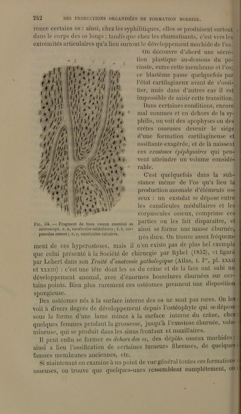 ronce certains os : ainsi, chez les syphilitiques, elles se produisent surtout dans le corps des os longs ; tandis que chez les rhumatisants, c’est vers les extrémités articulaires qu’a lieu surtout le développement morbide de l’os. Un découvre d’abord une sécré- tion plastique au-dessous du pé- : rioste, entre celle membrane et l’os; ; j ce blastème passe quelquefois par l’état cartilagineux avant de s’ossi- fier, mais dans d’autres cas il est impossible de saisir cette transition. Dans certaines conditions, encore mal connues et en dehors de la sy- philis, on voit des apophyses ou des crêtes osseuses devenir le siège d’une formation cartilagineuse et ossifiante exagérée, et de là naissent ces exostoses épiphysaires qui peu- vent atteindre un volume considé- rable. C’est quelquefois dans la sub- stance même de l’os qu’a lieu la production anomale d’éléments os- seux : un exsudât se dépose entre les canalicules médullaires et les corpuscules osseux, comprime ces „ ou v . , parties ou les fait disparaître, et Fig. 34. — Fragment de tissu osseux examine au r ? microscope, a, a, canalicules médullaires ; 6,6, cor- ainsi Se forme une masse éblirnéc, puscules osseux ; c, c, canalicules calcaires. , , , r\ , * très dure. On trouve assez Irequem- ment de ces hyperostoses, mais il n’en existe pas de plus bel exemple que celui présenté à la Société de chirurgie par ltybel (1852), cl figuré par Lebcrt dans son Traité d'anatomie pathologique (Atlas, t. I, ph xxxii et xxxm) : c’est une tête dont les os du crâne et de la lace ont subi un développement anomal, avec d’énormes bosselures éburnées sur cer- tains points. Bien plus rarement ces ostéomes prennent une disposition spongieuse. Des ostéomes nés à la surface interne des os ne sont pas rares. On les voit à divers degrés de développement depuis l’ostéophyte qui se dépose sous la forme d’une lame mince à la surface interne du crâne, chez quelques femmes pendant la grossesse, jusqu’à l’exostose éburnée, volu- mineuse, qui se produit dans les sinus frontaux et maxillaires. Il peut enfin se former en dehors des os, des dépôts osseux morbides : ainsi a lieu l’ossification de certaines tumeurs fibreuses, de quelques • fausses membranes anciennes, etc. Si maintenant on examine à un point de vue général louLes ces formations osseuses, on trouve que quelques-unes ressemblent complètement, ou