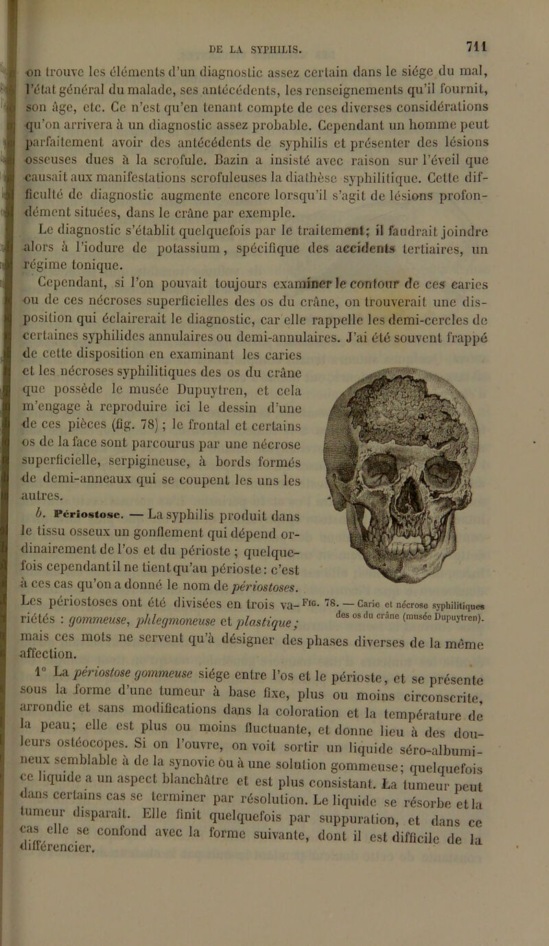 on trouve les éléments d’un, diagnostic assez certain dans le siège du mal, l’état général du malade, ses antécédents, les renseignements qu’il fournit, son âge, etc. Ce n’est qu’en tenant compte de ces diverses considérations qu’on arrivera à un diagnostic assez probable. Cependant un homme peut parfaitement avoir des antécédents de syphilis et présenter des lésions osseuses dues à la scrofule. Bazin a insisté avec raison sur l’éveil que causait aux manifestations scrofuleuses la diathèse syphilitique. Cette dif- ficulté de diagnostic augmente encore lorsqu’il s’agit de lésions profon- dément situées, dans le crâne par exemple. Le diagnostic s’établit quelquefois par le traitement; il faudrait joindre alors à l’iodure de potassium, spécifique des accidents tertiaires, un régime tonique. Cependant, si l’on pouvait toujours examiner le contour de ces caries ou de ces nécroses superficielles des os du crâne, on trouverait une dis- position qui éclairerait le diagnostic, car elle rappelle les demi-cercles de certaines syphilides annulaires ou demi-annulaires. J’ai été souvent frappé de cette disposition en examinant les caries et les nécroses syphilitiques des os du crâne que possède le musée Dupuytren, et cela m’engage à reproduire ici le dessin d’une de ces pièces (fig. 78) ; le frontal et certains os de la face sont parcourus par une nécrose superficielle, serpigineuse, à bords formés de demi-anneaux qui se coupent les uns les autres. b. Pcriostosc. — La syphilis produit dans le tissu osseux un gonflement qui dépend or- dinairement de l’os et du périoste ; quelque- fois cependantilne tientqu’au périoste: c’est à ces cas qu on a donné le nom de périostoses. Les péiiostoscs ont été divisées en trois va—— Carie et nécrose syphilitiques riétés : gommeuse, phlegmoneuse et plastique ; des °s du crâne (musde Dupuytrcn)- mais ces mots ne servent qu’à désigner des phases diverses de la même affection. 1° La périostose gommeuse siège entre l’os et le périoste, et se présente sous la forme d’une tumeur à base fixe, plus ou moins circonscrite arrondie et sans modifications dans la coloration et la température de la peau; elle est plus ou moins fluctuante, et donne lieu à des dou- leurs ostéocopes. Si on l’ouvre, on voit sortir un liquide séro-albumi- neux semblable a de la synovie ou à une solution gommeuse; quelquefois ce liquide a un aspect blanchâtre et est plus consistant. La tumeur peut dans certains cas se terminer par résolution. Le liquide se résorbe et la tumeur disparaît. Elle finit quelquefois par suppuration, et dans ce cas elle se confond avec la forme suivante, dont il est difficile de la différencier.