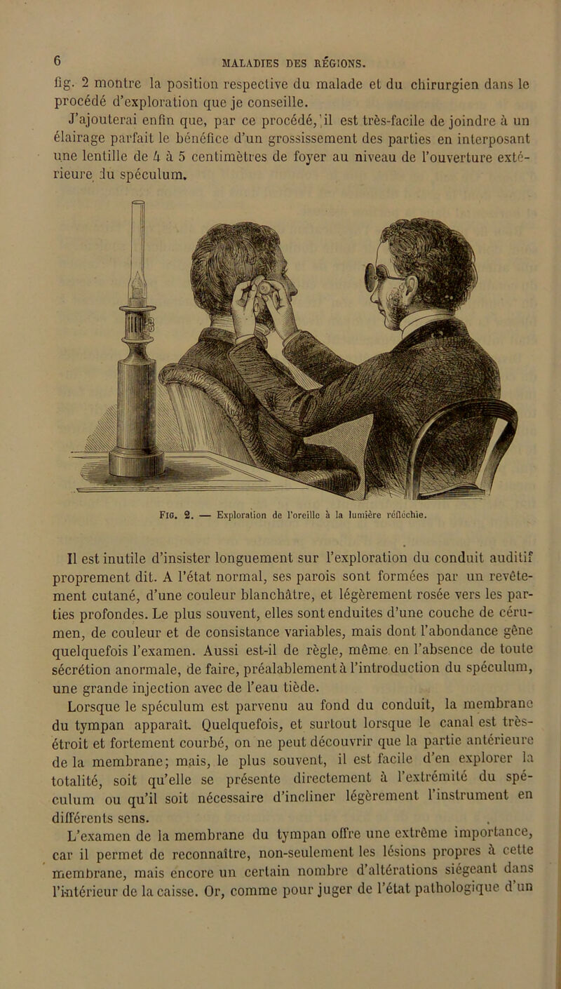 flg. 2 montre la position respective du malade et du chirurgien dans le procédé d’exploration que je conseille. J’ajouterai enfin que, par ce procédé,'il est très-facile de joindre a un élairage parfait le bénéfice d’un grossissement des parties en interposant une lentille de U à 5 centimètres de foyer au niveau de l’ouverture exté- rieure du spéculum. Fig. 2. — Exploration de l'oreille à la lumière réfléchie. Il est inutile d’insister longuement sur l’exploration du conduit auditif proprement dit. A l’état normal, ses parois sont formées par un revête- ment cutané, d’une couleur blanchâtre, et légèrement rosée vers les par- ties profondes. Le plus souvent, elles sont enduites d’une couche de céru- men, de couleur et de consistance variables, mais dont l’abondance gêne quelquefois l’examen. Aussi est-il de règle, même en l’absence de toute sécrétion anormale, de faire, préalablement à l’introduction du spéculum, une grande injection avec de l’eau tiède. Lorsque le spéculum est parvenu au fond du conduit, la membrane du tympan apparaît Quelquefois, et surtout lorsque le canal est très- étroit et fortement courbé, on ne peut découvrir que la partie antérieure delà membrane; mais, le plus souvent, il est facile d’en explorer la totalité, soit qu’elle se présente directement â l’extrémité du spé- culum ou qu’il soit nécessaire d’incliner légèrement l’instrument en différents sens. L’examen de la membrane du tympan offre une extrême importance, car il permet de reconnaître, non-seulement les lésions propres à cette membrane, mais encore un certain nombre d’altérations siégeant dans l’intérieur de la caisse. Or, comme pour juger de l’état pathologique d un