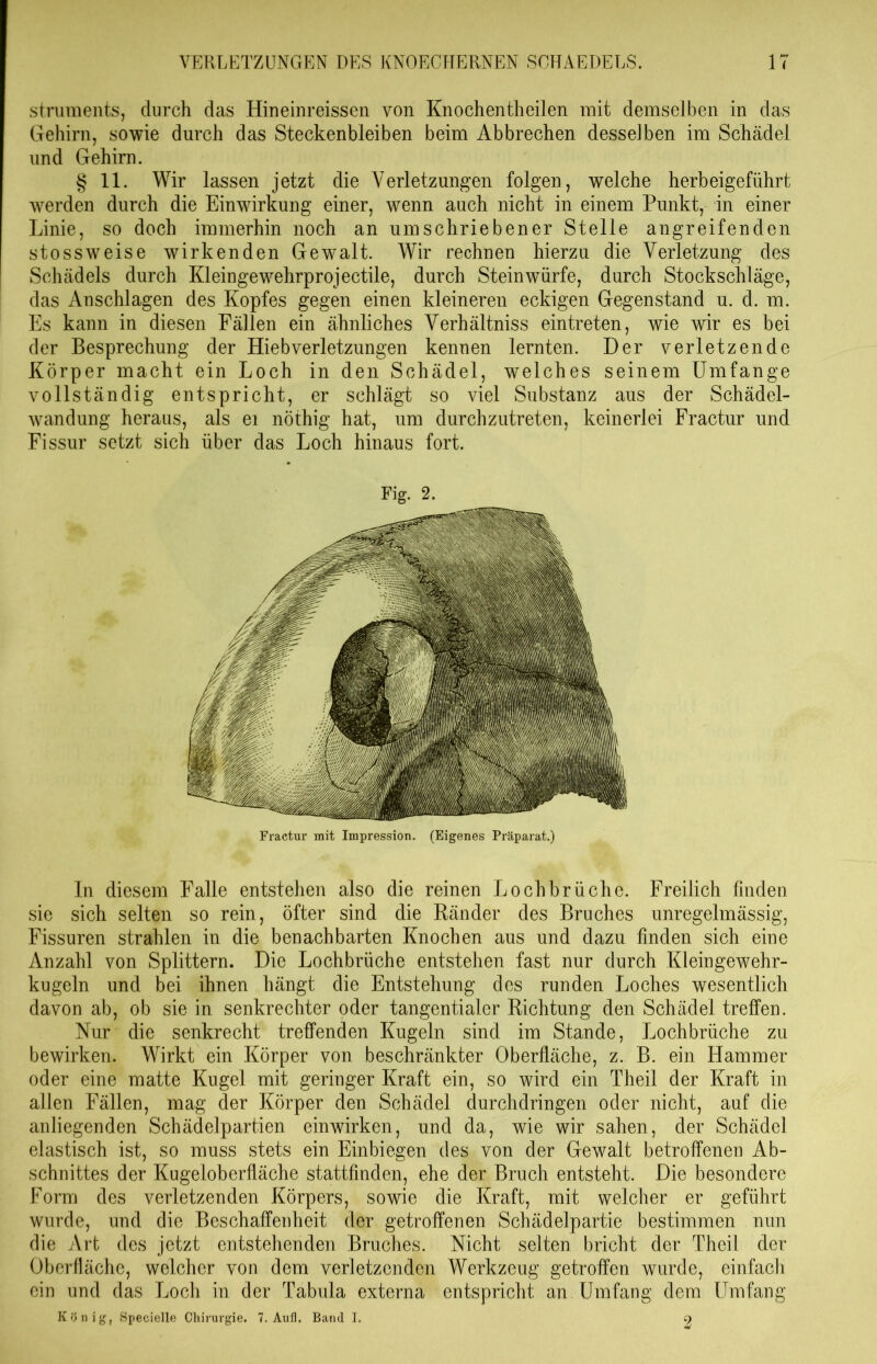 struments, durch das Hineinreissen von Knochentheilen mit demselben in das Gehirn, sowie durch das Steckenbleiben beim Abbrechen desselben im Schädel und Gehirn. § 11. Wir lassen jetzt die Verletzungen folgen, welche herbeigeführt werden durch die Einwirkung einer, wenn auch nicht in einem Punkt, in einer Linie, so doch immerhin noch an umschriebener Stelle angreifenden stossweise wirkenden Gewalt. Wir rechnen hierzu die Verletzung des Schädels durch Kleingewehrprojectile, durch Steinwürfe, durch Stockschläge, das Anschlägen des Kopfes gegen einen kleineren eckigen Gegenstand u. d. m. Es kann in diesen Fällen ein ähnliches Verhältniss eintreten, wie wir es bei der Besprechung der Hiebverletzungen kennen lernten. Der verletzende Körper macht ein Loch in den Schädel, welches seinem Umfange vollständig entspricht, er schlägt so viel Substanz aus der Schädel- wandung heraus, als ei nöthig hat, um durchzutreten, keinerlei Fractur und Fissur setzt sich über das Loch hinaus fort. Fig. 2. Fractur mit Impression. (Eigenes Präparat.) In diesem Falle entstehen also die reinen Lochbrüchc. Freilich finden sie sich selten so rein, öfter sind die Ränder des Bruches unregelmässig, Fissuren strahlen in die benachbarten Knochen aus und dazu finden sich eine Anzahl von Splittern. Die Lochbrüche entstehen fast nur durch Kleingewehr- kugeln und bei ihnen hängt die Entstehung des runden Loches wesentlich davon ab, ob sie in senkrechter oder tangentialer Richtung den Schädel treffen. Nur die senkrecht treffenden Kugeln sind im Stande, Lochbrüche zu bewirken. Wirkt ein Körper von beschränkter Oberfläche, z. B. ein Hammer oder eine matte Kugel mit geringer Kraft ein, so wird ein Theil der Kraft in allen Fällen, mag der Körper den Schädel durchdringen oder nicht, auf die anliegenden Schädelpartien einwirken, und da, wie wir sahen, der Schädel elastisch ist, so muss stets ein Einbiegen des von der Gewalt betroffenen Ab- schnittes der Kugeloberfläche stattfinden, ehe der Bruch entsteht. Die besondere Form des verletzenden Körpers, sowie die Kraft, mit welcher er geführt wurde, und die Beschaffenheit der getroffenen Schädelpartie bestimmen nun die Art des jetzt entstehenden Bruches. Nicht selten bricht der Theil der Oberfläche, welcher von dem verletzenden Werkzeug getroffen wurde, einfach ein und das Loch in der Tabula externa entspricht an. Umfang dem Umfang Künig, Specielle Chirurgie. 7. Aufl. Band I. 9