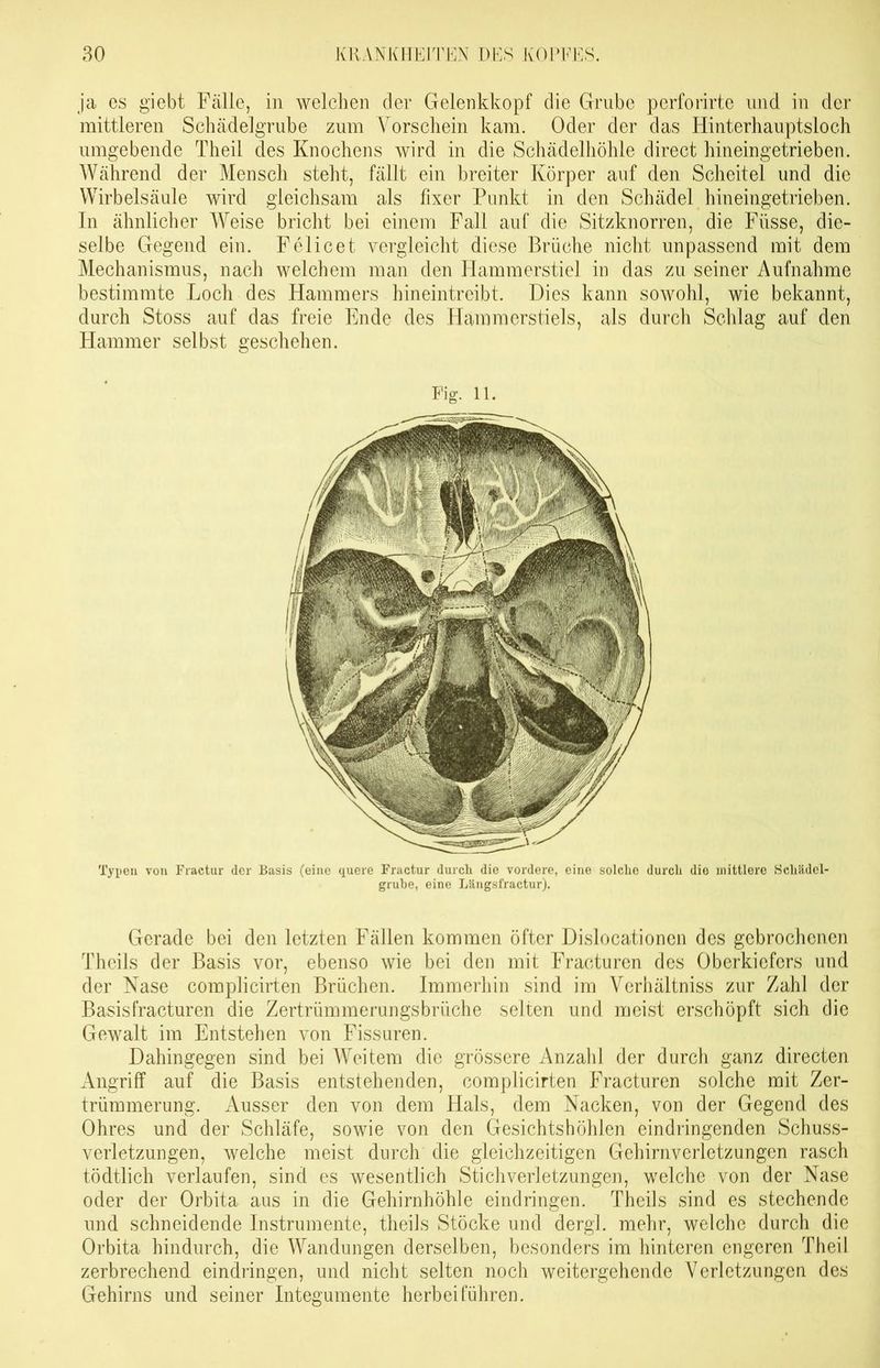 ja es giebt Fälle, in welchen der Gelenkkopf die Grube perforirte und in der mittleren Schädelgrube zum Vorschein kam. Oder der das Hinterhauptsloch umgebende Theil des Knochens wird in die Schädelhöhle direct hineingetrieben. Während der Mensch steht, fällt ein breiter Körper auf den Scheitel und die Wirbelsäule wird gleichsam als fixer Punkt in den Schädel hineingetrieben. In ähnlicher Weise bricht bei einem Fall auf die Sitzknorren, die Fiisse, die- selbe Gegend ein. Fe licet vergleicht diese Brüche nicht unpassend mit dem Mechanismus, nach welchem man den Hammerstiel in das zu seiner Aufnahme bestimmte Loch des Hammers hineintreibt. Dies kann sowohl, wie bekannt, durch Stoss auf das freie Ende des Hammerstiels, als durch Schlag auf den Hammer selbst geschehen. Fig. 11. Typen von Fractur der Basis (eine quere Fractur durch die vordere, eine solche durch die mittlere Schädel- grube, eine Längsfractur). Gerade bei den letzten Fällen kommen öfter Dislocationen des gebrochenen Thcils der Basis vor, ebenso wie bei den mit Fracturen des Oberkiefers und der Nase complicirten Brüchen. Immerhin sind im Verhältniss zur Zahl der Basis fracturen die Zertrümmerungsbrüche selten und meist erschöpft sich die Gewalt im Entstehen von Fissuren. Dahingegen sind bei Weitem die grössere Anzahl der durch ganz directen Angriff auf die Basis entstehenden, complicirten Fracturen solche mit Zer- trümmerung. Ausser den von dem Hals, dem Nacken, von der Gegend des Ohres und der Schläfe, sowie von den Gesichtshöhlen eindringenden Schuss- verletzungen, welche meist durch die gleichzeitigen Gehirnverletzungen rasch tödtlich verlaufen, sind es wesentlich Stichverletzungen, welche von der Nase oder der Orbita aus in die Gehirnhöhle eindringen. Theils sind es stechende und schneidende Instrumente, theils Stöcke und dergl. mehr, welche durch die Orbita hindurch, die Wandungen derselben, besonders im hinteren engeren Theil zerbrechend eindringen, und nicht selten noch weitergehende Verletzungen des Gehirns und seiner Integumente herbei führen.
