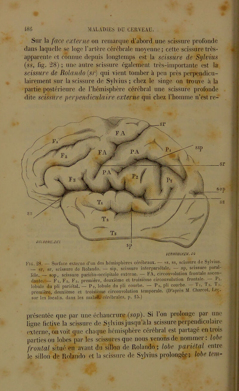 Sur la face externe ou remarque d’abord une scissure profonde dans laquelle se loge l’artère cérébrale moyenne; cette scissure très- apparente et connue depuis longtemps est la scissure de Sylvius (ss, fig. 28) ; une autre scissure également très-importante est la scissure de Rolando (sr) qui vient tomber à peu près perpendicu- lairement sur la scissure de Sylvius ; citez le singe on trouve à la partie postérieure de l’hémisphère cérébral une scissure profonde dite scissure perpendiculaire externe qui chez l’homme n’est re- _sr _S°p SS VE RMORCKEfJ. SC Fig. 28. — Surface externe d’un des hémisphères cérébraux. — ss, ss, scissure de Sylvius. — sr, sr, scissure de Rolando. — sip. scissure interpanétale. — sp, scissure paral- lèle. — sop, scissure pariéto-occipitale externe. — FA, circonvolution frontale ascen- dante. — Fi, F», F3, première, deuxième et troisième circonvolution frontale. — Pi. lobule du pli pariétal. — Ps, lobule du pli courbe. — Pa, pli courbe. — Ti, T s, Ta, première, deuxième et troisième circonvolution temporale. (D'après M Charcot, -cç. sur les localis. dans les malad.(cérébrales, p. 15.) Cn.OBME.CFL présentée que par une échancrure (sop). Si l’on prolonge par une ligne fictive la scissure de Sylvius jusqu’àla scissure perpendiculaire externe, on voit que chaque hémisphère cérébral est partagé en trois parties ou lobes par les scissures que nous venons de nommer: lobe frontal situé en avant du sillon de Rolando; lobe pariétal entre le sillon de Rolando et la scissure de Syjvius prolongée; lobe tem-