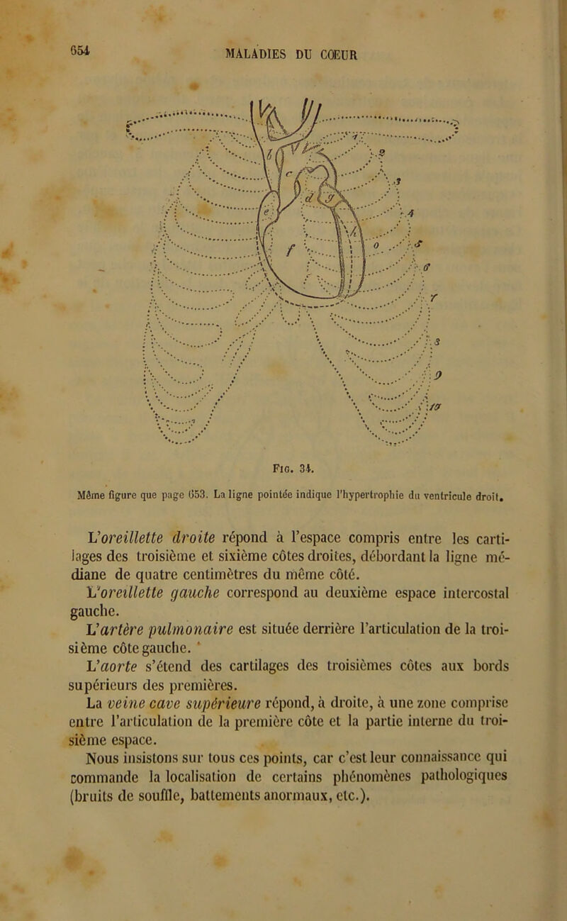 Même figure que page 053. La ligne pointée indique l'hypertrophie du ventricule droit. L'oreillette droite répond à l’espace compris entre les carti- lages des troisième et sixième côtes droites, débordant la ligne mé- diane de quatre centimètres du même côté. L'oreillette gauche correspond au deuxième espace intercostal gauche. L’artère pulmonaire est située derrière l’articulation de la troi- sième côte gauche. 4 L’aorte s’étend des cartilages des troisièmes côtes aux bords supérieurs des premières. La veine cave supérieure répond, à droite, à une zone comprise entre l’articulation de la première côte et la partie interne du troi- sième espace. Nous insistons sur tous ces points, car c’est leur connaissance qui commande la localisation de certains phénomènes pathologiques (bruits de souffle, battements anormaux, etc.).