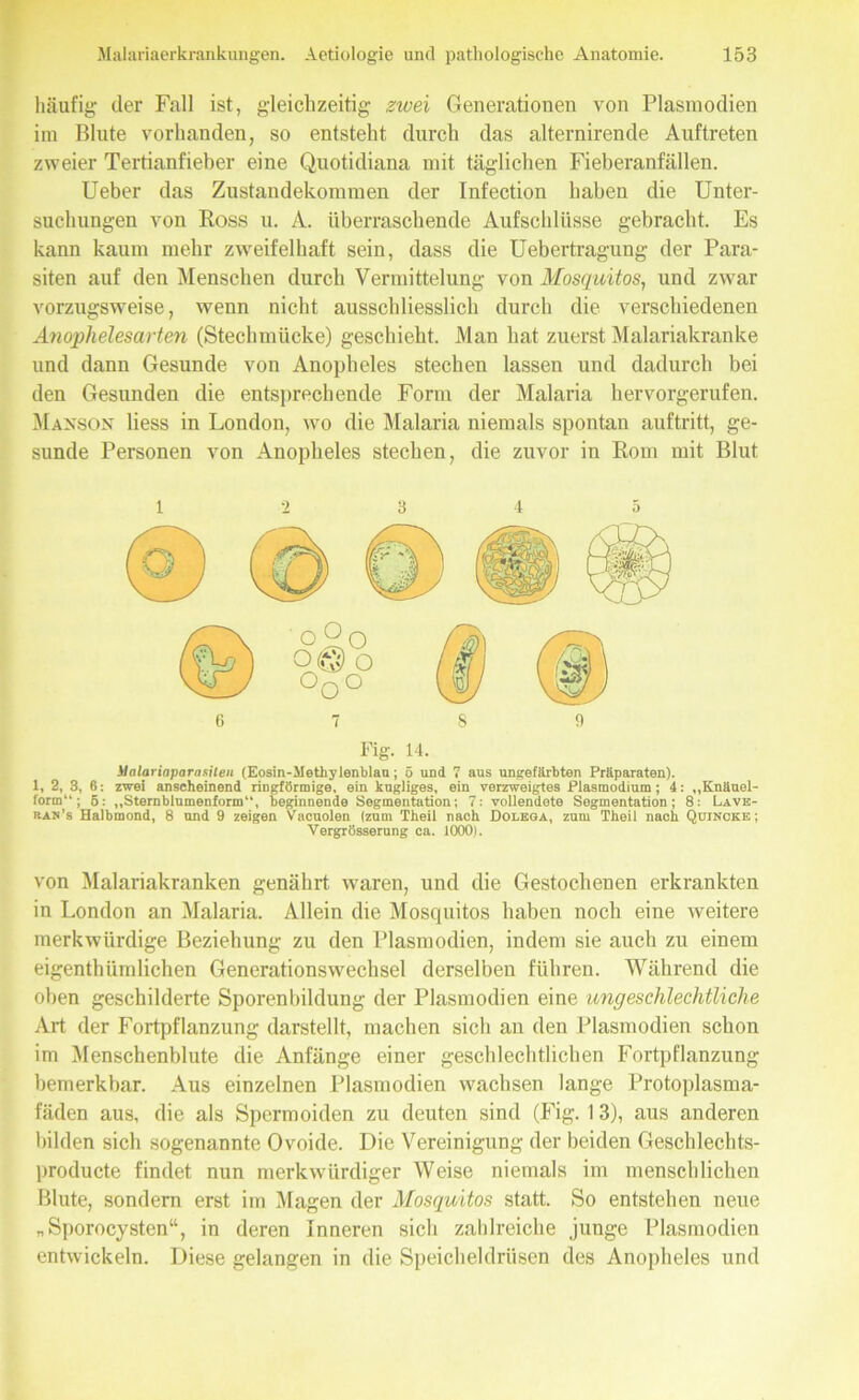 häufig der Fall ist, gleichzeitig zwei Generationen von Plasmodien im Blute vorhanden, so entsteht durch das alternirende Auftreten zweier Tertianfieber eine Quotidiana mit täglichen Fieberanfällen. Ueber das Zustandekommen der Infection haben die Unter- suchungen von Ross u. A. überraschende Aufschlüsse gebracht. Es kann kaum mehr zweifelhaft sein, dass die Uebertragung der Para- siten auf den Menschen durch Vermittelung von Mosquitos, und zwar vorzugsweise, wenn nicht ausschliesslich durch die verschiedenen Anophelesarten (Stechmücke) geschieht. Man hat zuerst Malariakranke und dann Gesunde von Anopheles stechen lassen und dadurch bei den Gesunden die entsprechende Form der Malaria hervorgerufen. Maxson liess in London, wo die Malaria niemals spontan auftritt, ge- sunde Personen von Anopheles stechen, die zuvor in Rom mit Blut o 2 o ' °o° o o 9 Fig. 14. ilalariaparasiien (Eosin-.Methylenblau; 5 und 7 aus ungefärbten Präparaten). 1, 2, 3, 6: zwei anscheinend ringförmige, ein kegliges, ein verzweigtes Plasmodium; 4: „Knäuel- form“; 6: „Sternblumenform“, beginnende Segmentation; 7: vollendete Segmentation; 8: Lave- ran’s Halbmond, 8 und 9 zeigen Vacuolen (zum Theil nach Dolega, zum Theil nach Quincke; Vergrösserung ca. 1000). von Malariakranken genährt waren, und die Gestochenen erkrankten in London an Malaria. Allein die Mosquitos haben noch eine weitere merkwürdige Beziehung zu den Plasmodien, indem sie auch zu einem eigentümlichen Generationswechsel derselben führen. Während die oben geschilderte Sporenbildung der Plasmodien eine ungeschlechtliche Art der Fortpflanzung darstellt, machen sich an den Plasmodien schon im Menschenbilde die Anfänge einer geschlechtlichen Fortpflanzung bemerkbar. Aus einzelnen Plasmodien wachsen lange Protoplasma- fäden aus, die als Spermoiden zu deuten sind (Fig. 13), aus anderen bilden sich sogenannte Ovoide. Die Vereinigung der beiden Geschlechts- producte findet nun merkwürdiger Weise niemals im menschlichen Blute, sondern erst im Magen der Mosquitos statt. So entstehen neue „Sporocysten“, in deren Inneren sich zahlreiche junge Plasmodien entwickeln. Diese gelangen in die Speicheldrüsen des Anopheles und