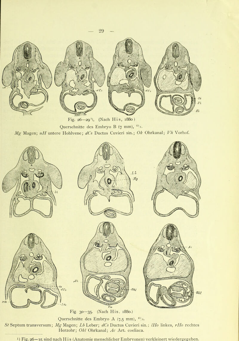 Querschnitte des Embryo B (7 mm), 151. Mg Magen; uH untere Hohlvene; dCs Ductus Cuvieri sin.; Ok Ohrkanal; Vh Vorhof. Querschnitte des Embryo A (7,5 mm), 15 1. St Septum transversum; Mg Magen; Lb Leber; dCs Ductus Cuvieri sin.; IHo linkes, rHo rechtes Herzohr; Okl Ohrkanal; Ac Art. coeliaca. t) Fig. 2.6—v. sind nach H i s (Anatomie menschlicher Embryonen) verkleinert wiedergegeben.