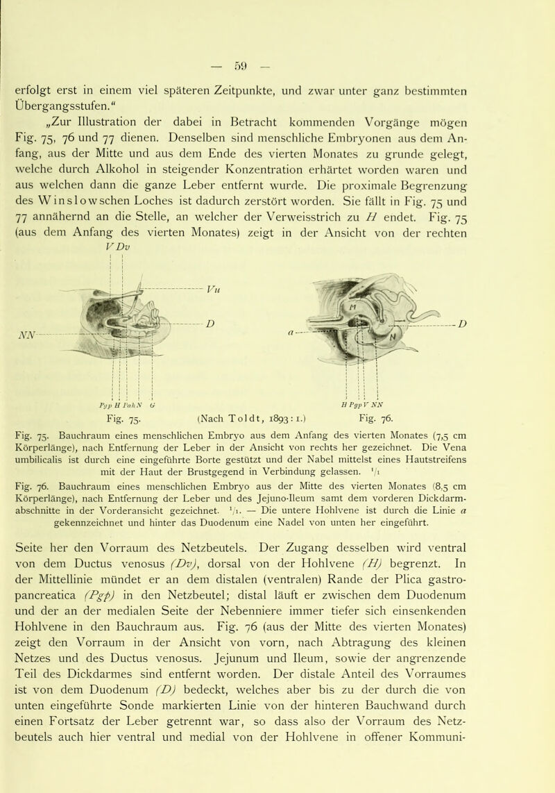 erfolgt erst in einem viel späteren Zeitpunkte, und zwar unter ganz bestimmten Übergangsstufen.'' „Zur Illustration der dabei in Betracht kommenden Vorgänge mögen Fig. 75, 76 und 77 dienen. Denselben sind menschliche Embryonen aus dem An- fang, aus der Mitte und aus dem Ende des vierten Monates zu gründe gelegt, welche durch Alkohol in steigender Konzentration erhärtet worden waren und aus welchen dann die ganze Leber entfernt wurde. Die proximale Begrenzung des Winslowschen Loches ist dadurch zerstört worden. Sie fällt in Fig. 75 und 77 annähernd an die Stelle, an welcher der Verweisstrich zu H endet. Fig. 75 (aus dem Anfang des vierten Monates) zeigt in der Ansicht von der rechten VDv XX Pyp U PahN G 11 Pgp V NN Fig- 75- (Nach Toi dt, 1893:1.) Fig. 76. Fig. 75. Bauchraum eines menschlichen Embryo aus dem Anfang des vierten Monates (7,5 cm Körperlänge), nach Entfernung der Leber in der Ansicht von rechts her gezeichnet. Die Vena umbilicalis ist durch eine eingeführte Borte gestützt und der Nabel mittelst eines Hautstreifens mit der Haut der Brustgegend in Verbindung gelassen. V1 Fig. 76. Bauchraum eines menschlichen Embryo aus der Mitte des vierten Monates (8,5 cm Körperlänge), nach Entfernung der Leber und des Jejuno-Ileum samt dem vorderen Dickdarm- abschnitte in der Vorderansicht gezeichnet. 1/i. — Die untere Hohlvene ist durch die Linie a gekennzeichnet und hinter das Duodenum eine Nadel von unten her eingeführt. Seite her den Vorraum des Netzbeutels. Der Zugang desselben wird ventral von dem Ductus venosus (Dv), dorsal von der Hohlvene (H) begrenzt. In der Mittellinie mündet er an dem distalen (ventralen) Rande der Plica gastro- pancreatica (Pgp) in den Netzbeutel; distal läuft er zwischen dem Duodenum und der an der medialen Seite der Nebenniere immer tiefer sich einsenkenden Hohlvene in den Bauchraum aus. Fig. 76 (aus der Mitte des vierten Monates) zeigt den Vorraum in der Ansicht von vorn, nach Abtragung des kleinen Netzes und des Ductus venosus. Jejunum und Ileum, sowie der angrenzende Teil des Dickdarmes sind entfernt worden. Der distale Anteil des Vorraumes ist von dem Duodenum (D) bedeckt, welches aber bis zu der durch die von unten eingeführte Sonde markierten Linie von der hinteren Bauchwand durch einen Fortsatz der Leber getrennt war, so dass also der Vorraum des Netz- beutels auch hier ventral und medial von der Hohlvene in offener Kommuni-