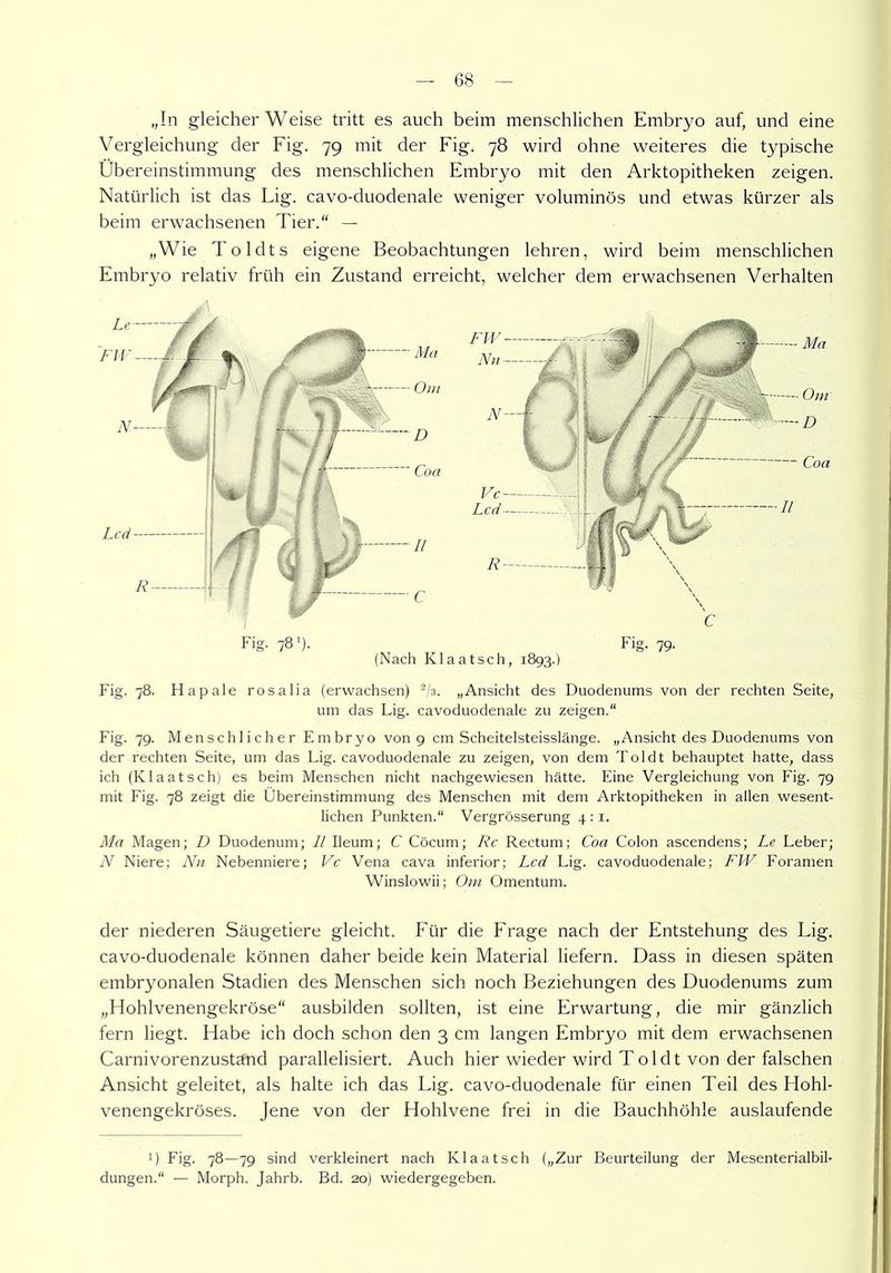 „In gleicherweise tritt es auch beim menschlichen Embryo auf, und eine Vergleichung der Fig. 79 mit der Fig, 78 wird ohne weiteres die typische Übereinstimmung des menschlichen Embryo mit den Arktopitheken zeigen. Natürlich ist das Lig. cavo-duodenale weniger voluminös und etwas kürzer als beim erwachsenen Tier.“ — „Wie Toldts eigene Beobachtungen lehren, wird beim menschlichen Embryo relativ früh ein Zustand erreicht, welcher dem erwachsenen Verhalten Fig. 78. Hapale rosalia (erwachsen) 2/3. „Ansicht des Duodenums von der rechten Seite, um das Lig. cavoduodenale zu zeigen.“ Fig. 79. Menschlicher Embryo von 9 cm Scheitelsteisslänge. „Ansicht des Duodenums von der rechten Seite, um das Lig. cavoduodenale zu zeigen, von dem Toi dt behauptet hatte, dass ich (Klaatsch) es beim Menschen nicht nachgewiesen hätte. Eine Vergleichung von Fig. 79 mit Fig. 78 zeigt die Übereinstimmung des Menschen mit dem Arktopitheken in allen wesent- lichen Punkten.“ Vergrösserung 4:1. Ma Magen; D Duodenum; II Ileum; C Cöcum; Rc Rectum; Coa Colon ascendens; Le Leber; N Niere; Nu Nebenniere; Vc Vena cava inferior; Lcd Lig. cavoduodenale; FW Foramen Winslowii; Om Omentum. der niederen Säugetiere gleicht. Für die Frage nach der Entstehung des Fig. cavo-duodenale können daher beide kein Material liefern. Dass in diesen späten embryonalen Stadien des Menschen sich noch Beziehungen des Duodenums zum „Hohlvenengekröse“ ausbilden sollten, ist eine Erwartung, die mir gänzlich fern liegt. Habe ich doch schon den 3 cm langen Embryo mit dem erwachsenen Carnivorenzustand parallelisiert. Auch hier wieder wird Toldt von der falschen Ansicht geleitet, als halte ich das Lig. cavo-duodenale für einen Teil des Hohl- venengekröses. Jene von der Hohlvene frei in die Bauchhöhle auslaufende 1) Fig. 78—79 sind verkleinert nach Klaatsch („Zur Beurteilung der Mesenterialbil- dungen.“ — Morph. Jahrb. Bd. 20) wiedergegeben.