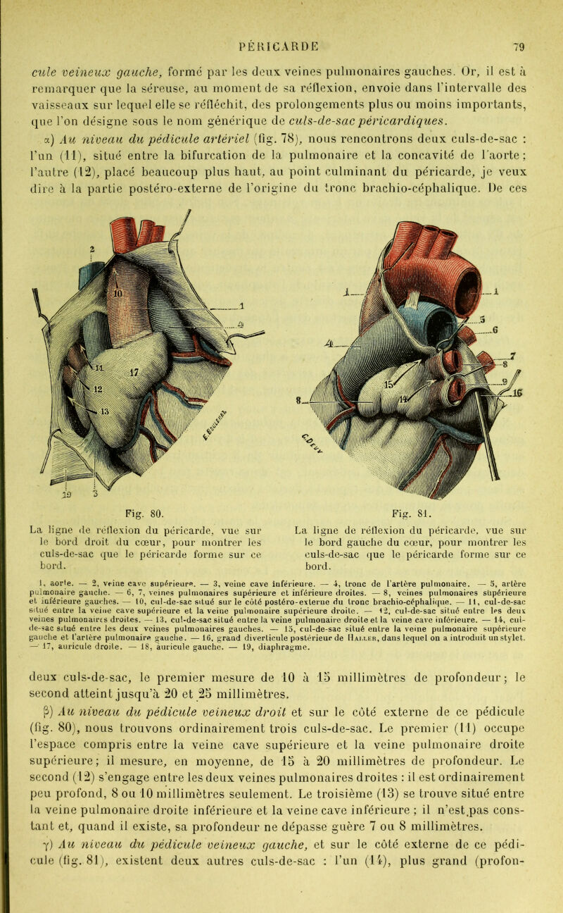 cule veineux gauche, forme par les deux veines pulmonaires gauches. Or, il est à remarquer que la séreuse, au moment de sa réfiexion, envoie dans l’intervalle des vaisseaux sur lequel elle se réfléchit, des prolongements plus ou moins importants, que l’on désigne sous le nom générique de culs-de-sac péricardiques. a) Au niceait du pédicule artériel (fig. 78), nous rencontrons deux culs-de-sac : l’un (il), situé entre la bifurcation de la pulmonaire et la concavité de l’aorte; l’autre (12), placé beaucoup plus haut, au point culminant du péricarde, je veux dire à la partie postéro-externe de l’origine du tronc brachio-céphalique. De ces Fig. 80. La ligne de réllexion du péricarde, vue sur le bord droit du cœur, pour montrer les cuis-de-sac que le péricarde forme sur ce bord. Fig. 81. La ligne de rélïe.xion du péricarde, vue sur le bord gauche du cœur, pour montrer les culs-de-sac que le péricarde forme sur ce bord. 1, aorte. — 2, veine cave supérieure. — .3, veine cave inférieure. — 4, tronc de l’artère pulmonaire. — 5, artère pulmonaire gauclie. — 6, 7, veines pulmonaires supérieure et inférieure droites. — 8, veines pulmonaires supérieure et inférieure gauches. — 10, cul-de-sac situé sur le côté postéro-externe du tronc brachio-céphalique. — 11, cul-de-sac situé entre la veine cave supérieure et la veine pulmonaire supérieure droite. — 12, cul-de-sac situé entre les deux veines pulraonairts droites. — 13, cul-de-sac situé entre la veine pulmonaire droite et la veine cave inférieure. — 14, cul- de-sac Situé entre les deux veines pulmonaires gauches. — 15, cul-de-sac situé entre la veine pulmonaire supérieure gauche et Tarière pulmonaire «auche. —16, grand diverticule postérieur de Hai.ler, dans lequel on a introduit un stylet. — 17, auricule droite. — 18, àuricule gauche. — 19, diaphragme. deux culs-de-sac, le premier mesure de 10 à 15 millimètres de profondeur; le second atteint jusqu’à 20 et 25 millimètres. P) Au nireau du pédicule veineux droit et sur le côté externe de ce pédicule (fig. 80), nous trouvons ordinairement trois culs-de-sac. Le premier (M) occupe l’espace compris entre la veine cave supérieure et la veine pulmonaire droite supérieure; il mesure, en moyenne, de 15 à 20 millimètres de profondeur. Le second (12) s’engage entre les deux veines pulmonaires droites : il est ordinairement peu profond, 8 ou 10 millimètres seulement. Le troisième (13) se trouve situé entre la veine pulmonaire droite inférieure et la veine cave inférieure ; il n’est.pas cons- tant et, quand il existe, sa profondeur ne dépasse guère 7 ou 8 millimètres. y) Au niveau du pédicule veineux gauche, et sur le coté externe de ce pédi- cule (fig. 81), existent deux autres culs-de-sac : l’un (11), plus grand (profon-
