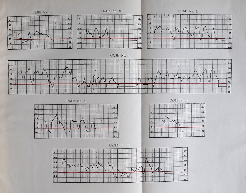 CASE No. 2. CASE No. 3. 120 no 100 A A A 90 i 1 1 A 80 30 to J t 70 $0 CASE No. 5. CASE , No. 6. 41 —n 120 40 110 39 r\ i 100 3fl M yj v\ J vL 4 a 90 37 \ : . )k : A 4 A 60 3ft u ;v 4 J sr— 70 ' 60