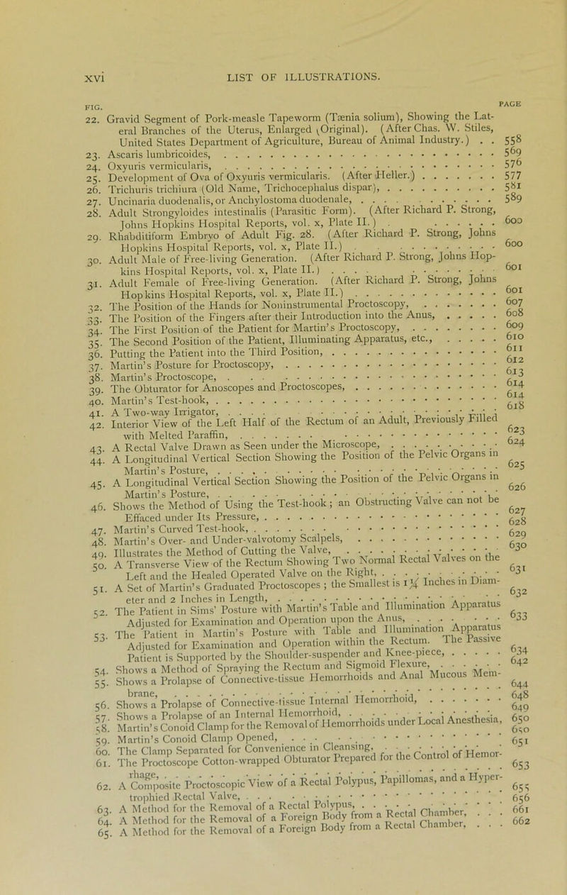 FIG. PAGE 22. Gravid Segment of Pork-measle Tapeworm (Taenia solium), Showing the Lat- eral Branches of the Uterus, Enlarged (Original). (AfterChas. W. Stiles, United States Department of Agriculture, Bureau of Animal Industry.) . . 558 23. Ascaris lumbricoides, 5^9 24. Oxyuris vermicularis, 57b 25. Development of Ova of Oxyuris vermicularis. (After Heller.) 577 26. Trichuris trichiura (Old Name, Trichocephalus dispar), 5*1 27. Uncinaria duodenalis, or Anchylostoma duodenale 5°9 28. Adult Strongyloides intestinalis (Parasitic Form). (After Richard P. Strong, Johns Hopkins Hospital Reports, vol. x, Plate II.) . ...... 600 29. Rhabditiform Embryo of Adult Fig. 28. (After Richard P. Strong, Johns Hopkins Hospital Reports, vol. x, Plate II.) ...... . . . 600 30. Adult Male of Free-living Generation. (After Richard P. Strong, Johns Flop- kins Hospital Reports, vol. x, Plate II.) .... ••••••■ °01 31. Adult Female of Free-living Generation. (After Richard P. Strong, Johns Hopkins Hospital Reports, vol. x, Plate II.) °01 32. The Position of the Hands for Noninstrumental Proctoscopy 007 33. The Position of the Fingers after their Introduction into the Anus, °oS 34. The First Position of the Patient for Martin’s Proctoscopy, o°9 35. The Second Position of the Patient, Illuminating Apparatus, etc., bio 36. Putting the Patient into the Third Position, ** 37. Martin’s Posture for Proctoscopy, 38. Martin’s Proctoscope, •> 39. The Obturator for Anoscopes and Proctoscopes °*4 40. Martin’s Test-hook, 41. A Two-way Irrigator, .... • • • • • • • : • .* j 42. Interior View of the Left Half of the Rectum of an Adult, Previously Filled with Melted Paraffin, , “ 43 A Rectal Valve Drawn as Seen under the Microscope, . . ...... • °24 44. A Longitudinal Vertical Section Showing the Position of the Pelvic Organs in Martin’s Posture, -* 45. A Longitudinal Vertical Section Showing the Position of the Pelvic Organs in ^ Martin’s Posture, • ■ • •. • ;r ‘ • ‘ 46. Shows the Method of Using the Test-hook; an Obstructing Valve can not be Effaced under Its Pressure, 6zg 47. Martin’s Curved Test-hook, g 48. Martin’s Over- and Under-valvotomy Scalpels ? 49. Illustrates the Method of Cutting the Valve .. . . . 3 to A Transverse View of the Rectum Showing Two Normal Rectal \ alses on the Left and the Healed Operated Valve on the Right . • J 51. A Set of Martin’s Graduated Proctoscopes ; the Smallest is l,{ Inches in D . ^ 5- Tffi^Pa tient in'.Shn s’ Posture'witli MaVtin’s Table and‘illumination Apparatus Adjusted for Examination and Operation upon the Anus, . . . • •• • 53. The Patient in Martin’s Posture with Table and Ulummation Appara us 5 Adjusted for Examination and Operation within the Rectum, rhe Passive Patient is Supported by the Shoulder-suspender and Knee-piece, »34 54. Shows a Method of Spraying the Rectum and Sigmoid Fiexure, . • ^ • • 4 55. Shows a Prolapse of Connective-tissue Hemorrhoids and Anal Mucous Met . ^ 56. Shows a Prolapse of Connective-tissue Internal Hemorrhoid 648 Martin’* Kffid Clampfor SeSovalof Hemorrhoids under Locai Anesthesia, 650 49. Martin’s Conoid Clamp Opened, ••.•••. 651 I?: for 0.e if taW ^ 62. A Composite Proctoscopic View of a Rectal Polypus, Papillomas, and a Hyper- ^ trophied Rectal Valve, • 656 63. A Method for the Removal of a Rectal Polypus, . •••• „, 0' ‘ 661 64. A Method for the Removal of a Foreign Body from a Recta Chamber, . . 65. A Method for the Removal of a Foreign Body from a Rectal Chamber, . .