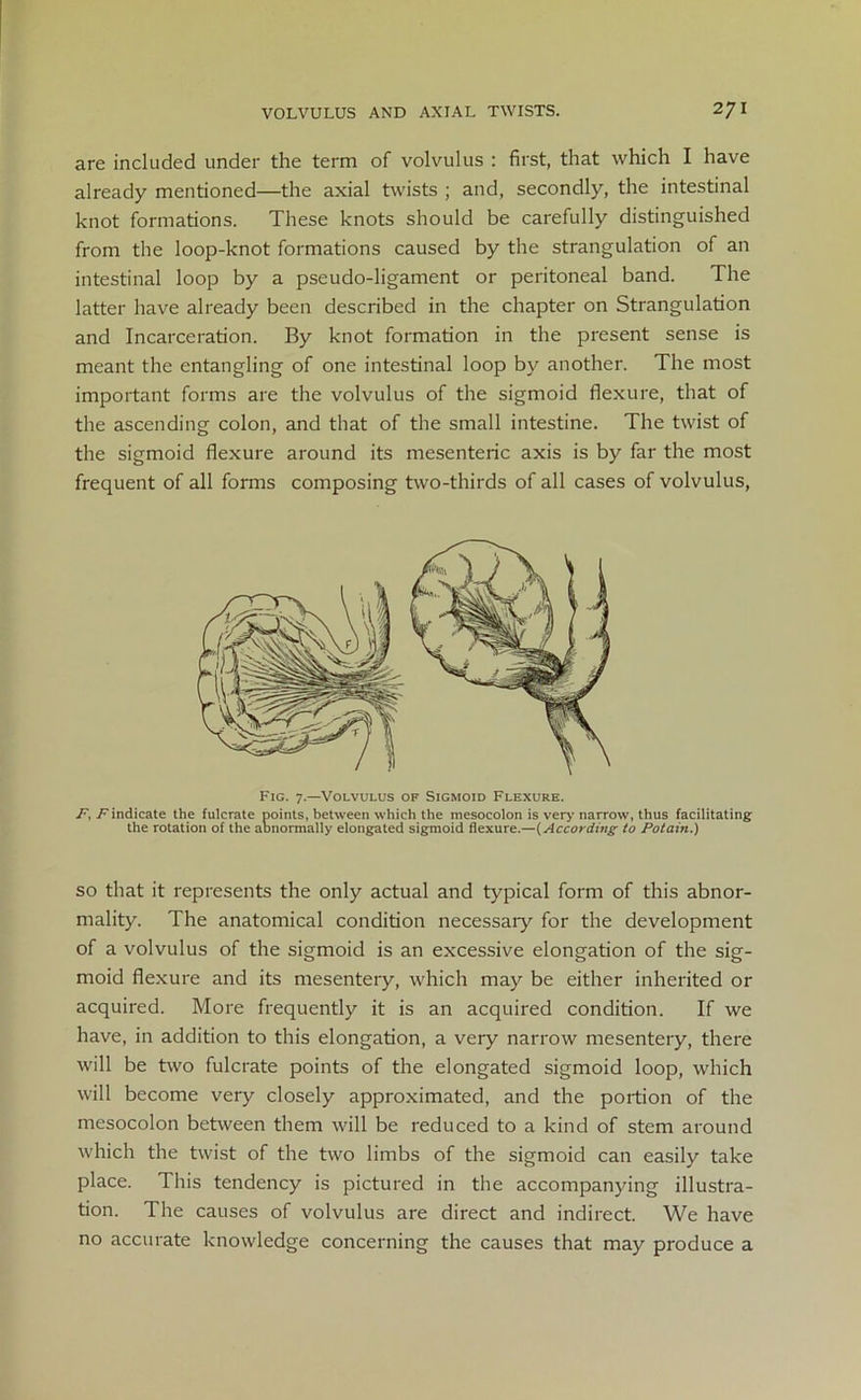 are included under the term of volvulus : first, that which I have already mentioned—the axial twists ; and, secondly, the intestinal knot formations. These knots should be carefully distinguished from the loop-knot formations caused by the strangulation of an intestinal loop by a pseudo-ligament or peritoneal band. The latter have already been described in the chapter on Strangulation and Incarceration. By knot formation in the present sense is meant the entangling of one intestinal loop by another. The most important forms are the volvulus of the sigmoid flexure, that of the ascending colon, and that of the small intestine. The twist of the sigmoid flexure around its mesenteric axis is by far the most frequent of all forms composing two-thirds of all cases of volvulus, Fig. 7.—Volvulus of Sigmoid Flexure. F, F indicate the lulcrate points, between which the mesocolon is very narrow, thus facilitating the rotation of the abnormally elongated sigmoid flexure.—(According to Potain.) so that it represents the only actual and typical form of this abnor- mality. The anatomical condition necessary for the development of a volvulus of the sigmoid is an excessive elongation of the sig- moid flexure and its mesentery, which may be either inherited or acquired. More frequently it is an acquired condition. If we have, in addition to this elongation, a very narrow mesentery, there will be two fulcrate points of the elongated sigmoid loop, which will become very closely approximated, and the portion of the mesocolon between them will be reduced to a kind of stem around which the twist of the two limbs of the sigmoid can easily take place. This tendency is pictured in the accompanying illustra- tion. The causes of volvulus are direct and indirect. We have no accurate knowledge concerning the causes that may produce a