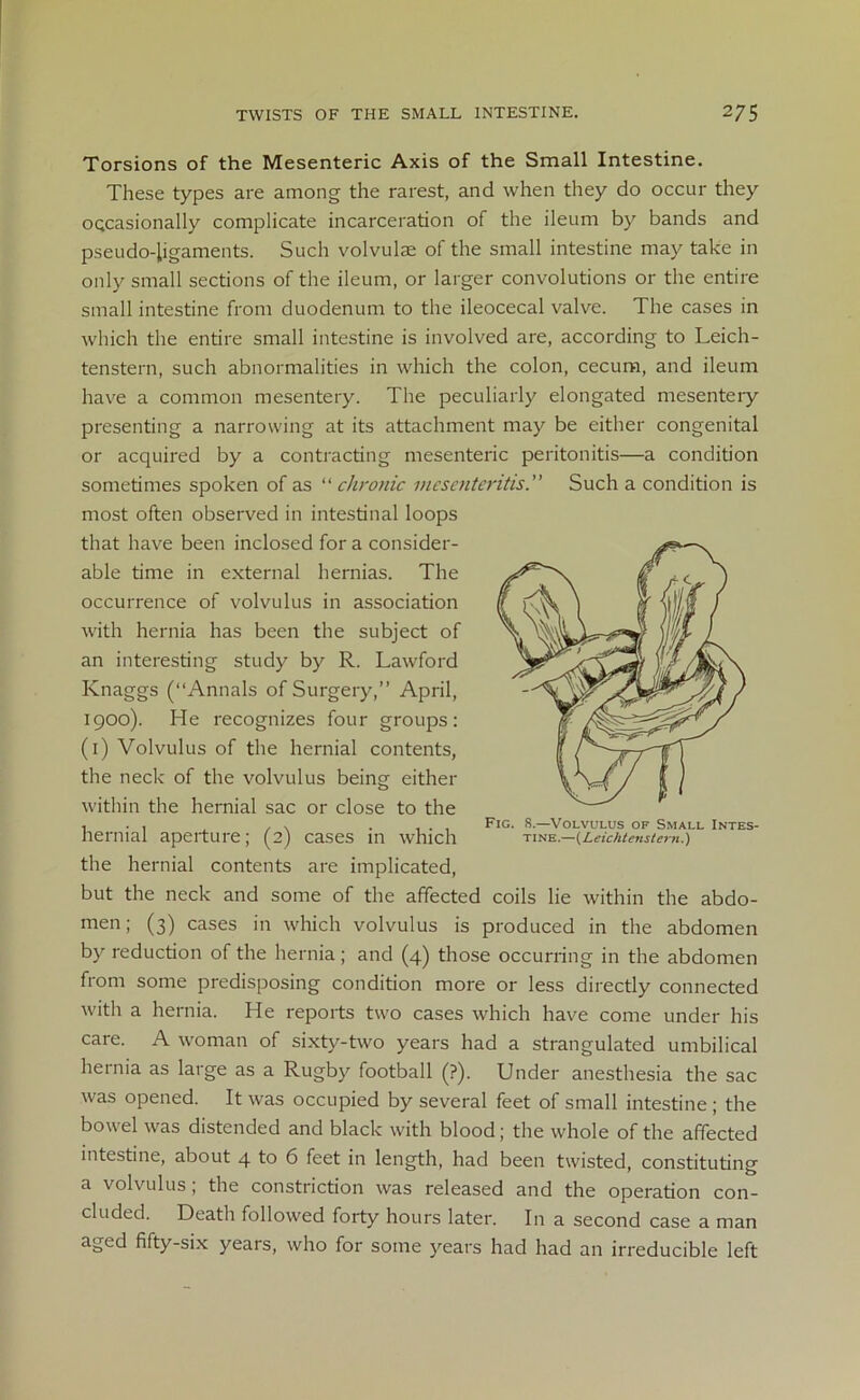 Torsions of the Mesenteric Axis of the Small Intestine. These types are among the rarest, and when they do occur they occasionally complicate incarceration of the ileum by bands and pseudo-ligaments. Such volvulse of the small intestine may take in only small sections of the ileum, or larger convolutions or the entire small intestine from duodenum to the ileocecal valve. The cases in which the entire small intestine is involved are, according to Leich- tenstern, such abnormalities in which the colon, cecum, and ileum have a common mesentery. The peculiarly elongated mesentery presenting a narrowing at its attachment may be either congenital or acquired by a contracting mesenteric peritonitis—a condition sometimes spoken of as “ chronic mesenteritis.” Such a condition is most often observed in intestinal loops that have been inclosed for a consider- able time in external hernias. The occurrence of volvulus in association with hernia has been the subject of an interesting study by R. Lawford Knaggs (“Annals of Surgery,” April, 1900). He recognizes four groups: (1) Volvulus of the hernial contents, the neck of the volvulus being either within the hernial sac or close to the hernial aperture; (2) cases in which the hernial contents are implicated, but the neck and some of the affected coils lie within the abdo- men; (3) cases in which volvulus is produced in the abdomen by reduction of the hernia; and (4) those occurring in the abdomen from some predisposing condition more or less directly connected with a hernia. He reports two cases which have come under his care. A woman of sixty-two years had a strangulated umbilical hernia as large as a Rugby football (?). Under anesthesia the sac was opened. It was occupied by several feet of small intestine ; the bowel was distended and black with blood; the whole of the affected intestine, about 4 to 6 feet in length, had been twisted, constituting a volvulus , the constriction was released and the operation con- cluded. Death followed forty hours later. In a second case a man aged fifty-six years, who for some years had had an irreducible left Fig. 8.—Volvulus of Small Intes- tine.—(Leichtenstern.)