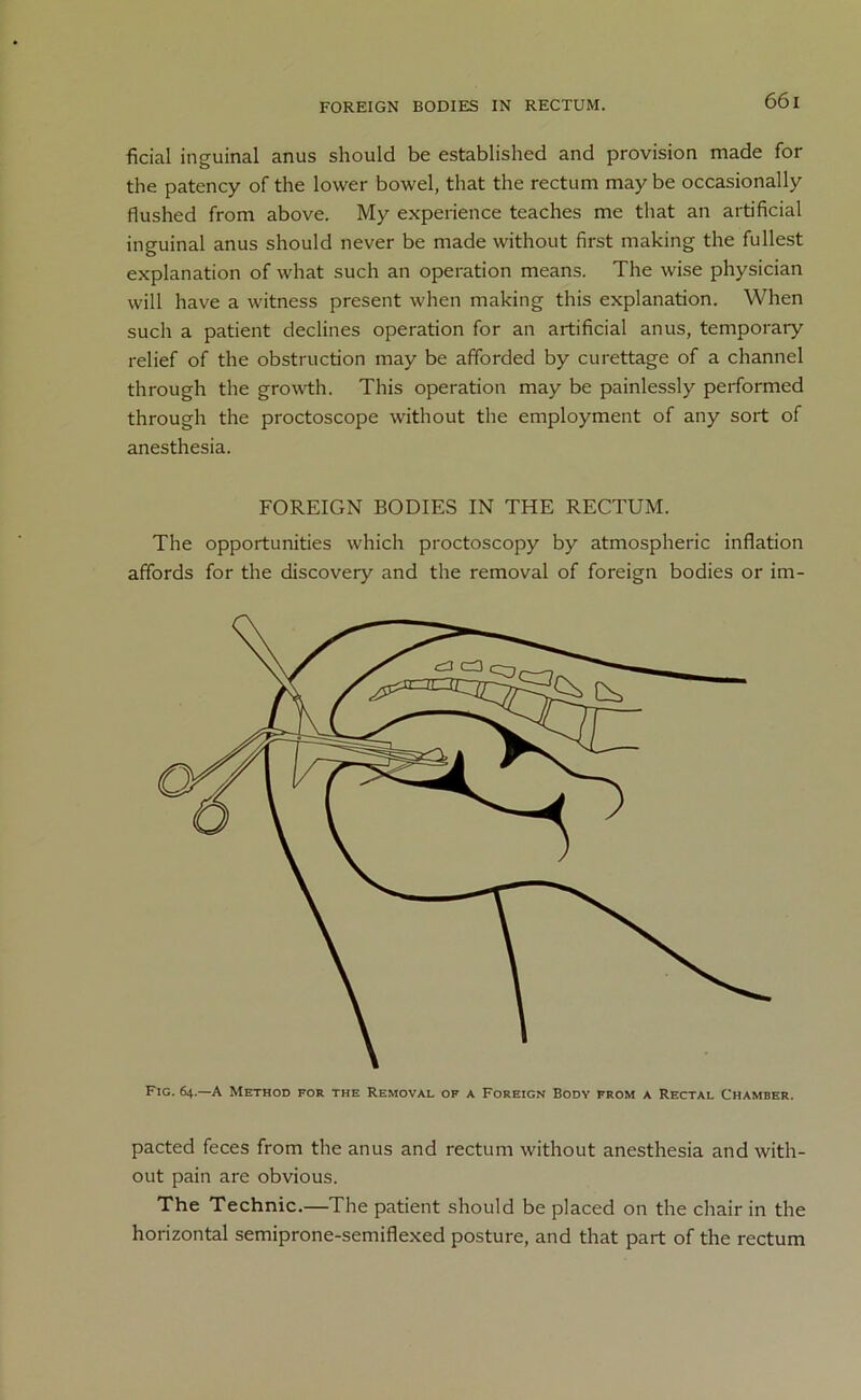 FOREIGN BODIES IN RECTUM. ficial inguinal anus should be established and provision made for the patency of the lower bowel, that the rectum may be occasionally flushed from above. My experience teaches me that an artificial inguinal anus should never be made without first making the fullest explanation of what such an operation means. The wise physician will have a witness present when making this explanation. When such a patient declines operation for an artificial anus, temporary relief of the obstruction may be afforded by curettage of a channel through the growth. This operation may be painlessly performed through the proctoscope without the employment of any sort of anesthesia. FOREIGN BODIES IN THE RECTUM. The opportunities which proctoscopy by atmospheric inflation affords for the discovery and the removal of foreign bodies or im- Fig. 64.—A Method for the Removal of a Foreign Body from a Rectal Chamber. pacted feces from the anus and rectum without anesthesia and with- out pain are obvious. The Technic.—The patient should be placed on the chair in the horizontal semiprone-semiflexed posture, and that part of the rectum