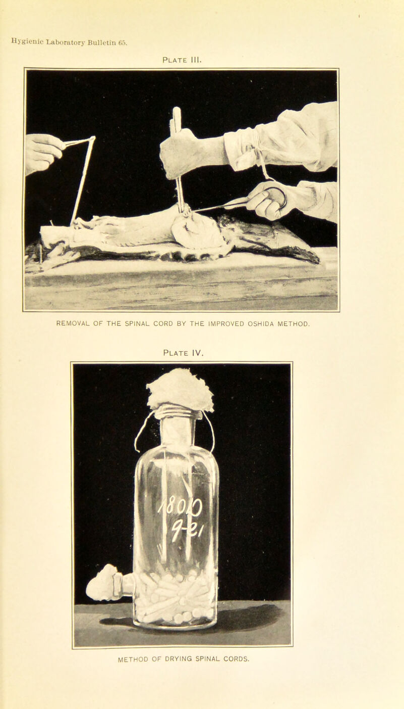 Plate III. REMOVAL OF THE SPINAL CORD BY THE IMPROVED OSHIDA METHOD. Plate IV. METHOD OF DRYING SPINAL CORDS.