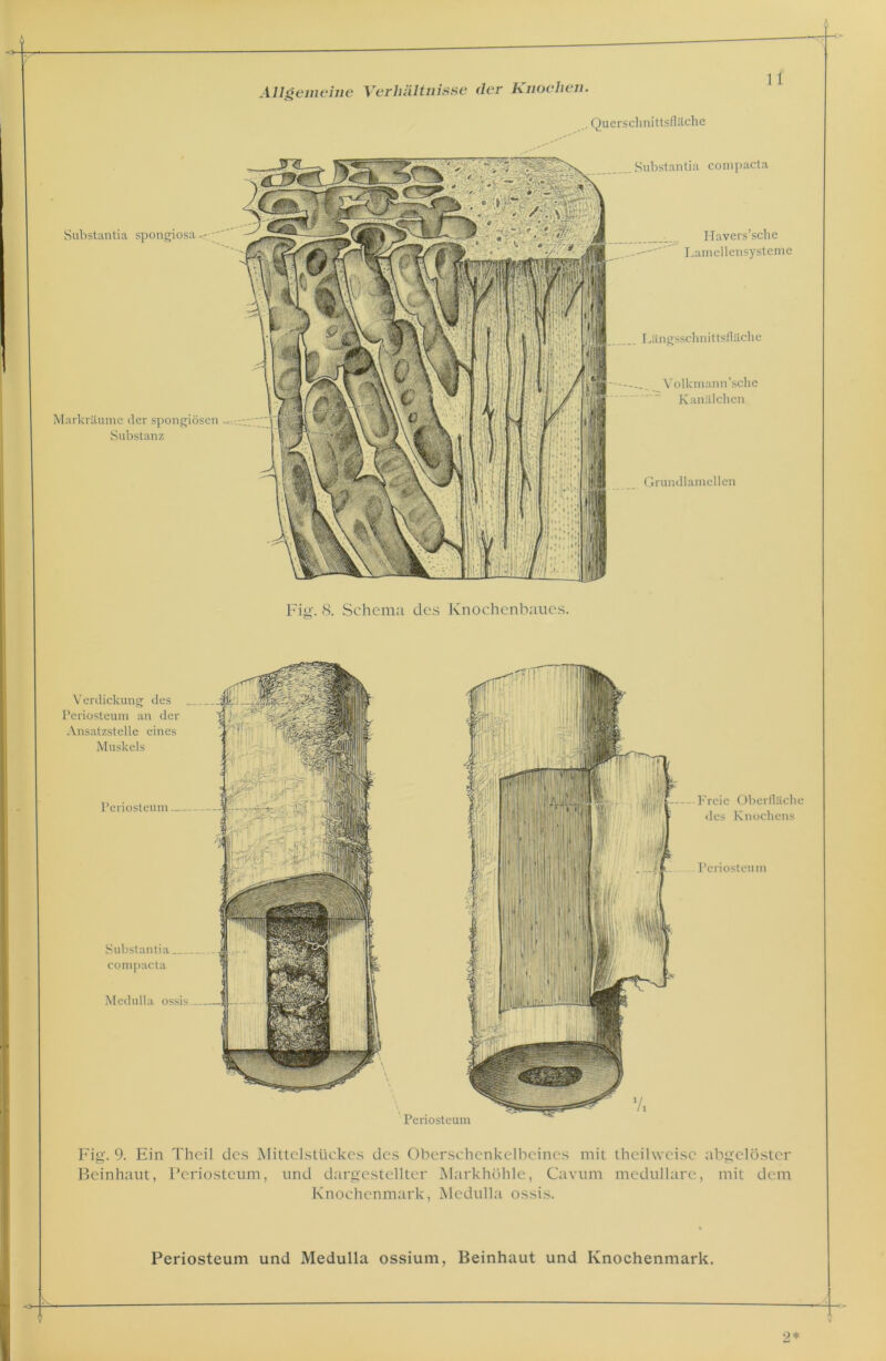 .. Querschnittsfläche Substantia spongiosa Markräume der spongiösen Substanz ''i fff] ~ Uly k\\ \} ^ LV j \ * Substantia compacta Havers’sclie Lamellensysteme Längsschnittsfläche Volkmann’sche Kanälchen Grundlamellen Fig. 8. Schema des Knochenbaues. Verdickung des Periosteum an der Ansatzstelle eines Muskels Periosteum Substantia compacta Medulla ossis Freie Oberfläche des Knochens Periosteum Fig. 9. Ein Theil des Mittelstückes des Oberschenkelbeines mit theihveisc abgelöstcr Beinhaut, Periosteum, und dargestellter Markhöhle, Carum medulläre, mit dem Knochenmark, Medulla ossis. . Periosteum und Medulla ossium, Beinhaut und Knochenmark.