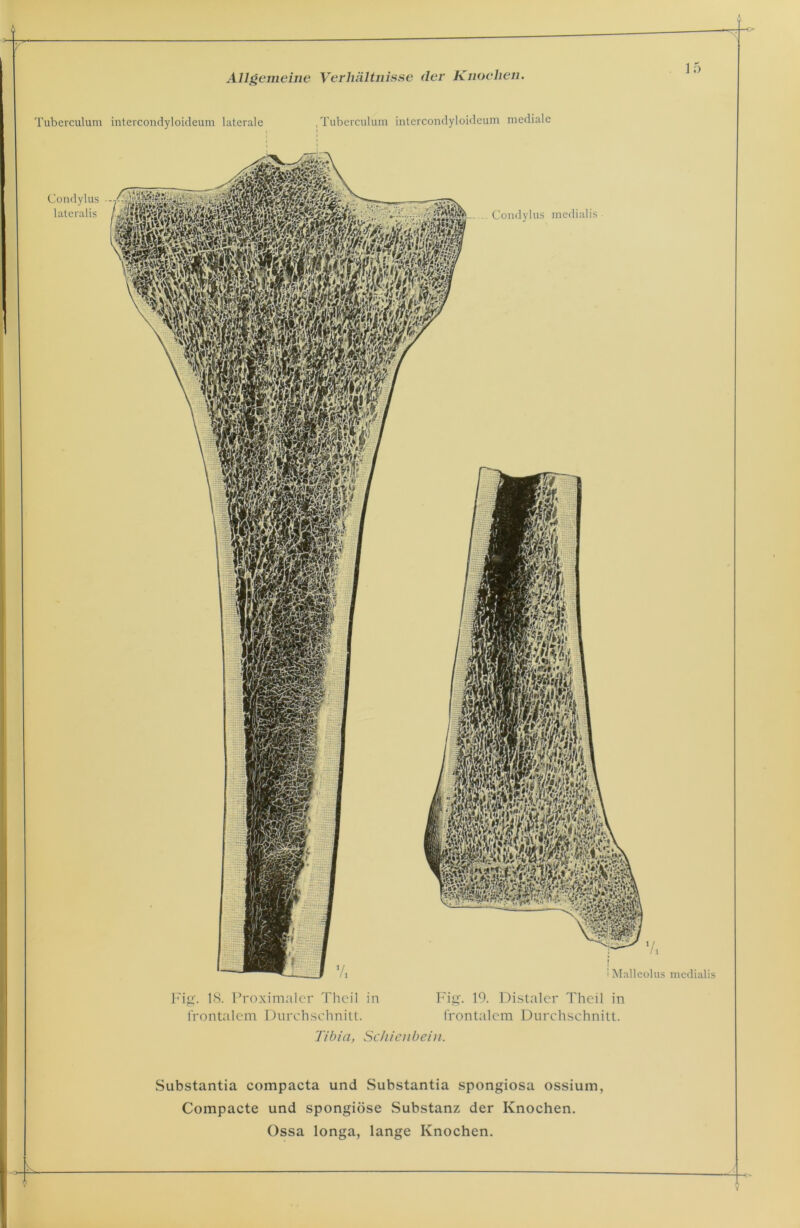 Fig. 18. Proximaler Thcil in Fig. 19. Distaler Theil in frontalem Durchschnitt. frontalem Durchschnitt. Tibia, Schienbein. Substantia compacta und Substantia spongiosa ossium, Compacte und spongiöse Substanz der Knochen.