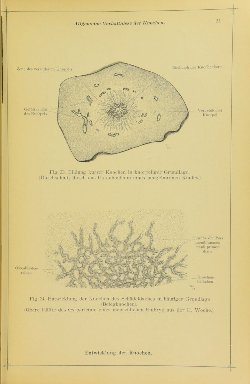 r Zone des veränderten Knorpels Enchondraler Gefässkanäle des Knorpels Knochenkern Yorgebildeter Knorpel Fig. 33. Bildung kurzer Knochen in knorpeliger Grundlage. (Durchschnitt durch das Os cuboideum eines neugeborenen Kindes.) Osteoblastcn- reihen Gewebe der Pars membranacea cranii primor- dialis Knochen- bälkchen Fig. 34. Entwicklung der Knochen des Schädeldaches in häutiger Grundlage (Belegknochen). (Obere Hälfte des Os parietale eines menschlichen Embryo aus der 11. Woche.)